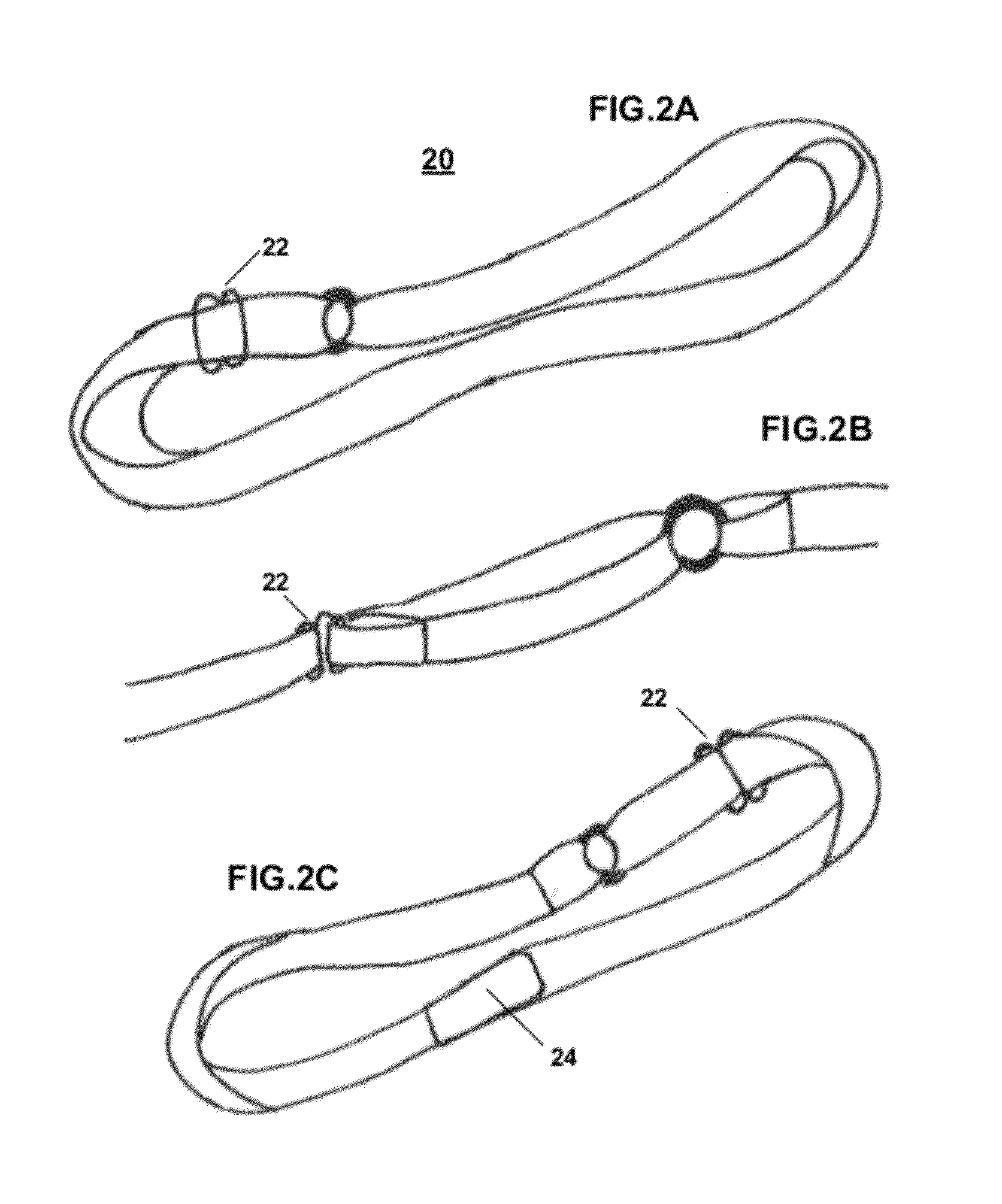 Modular upper extremity support system