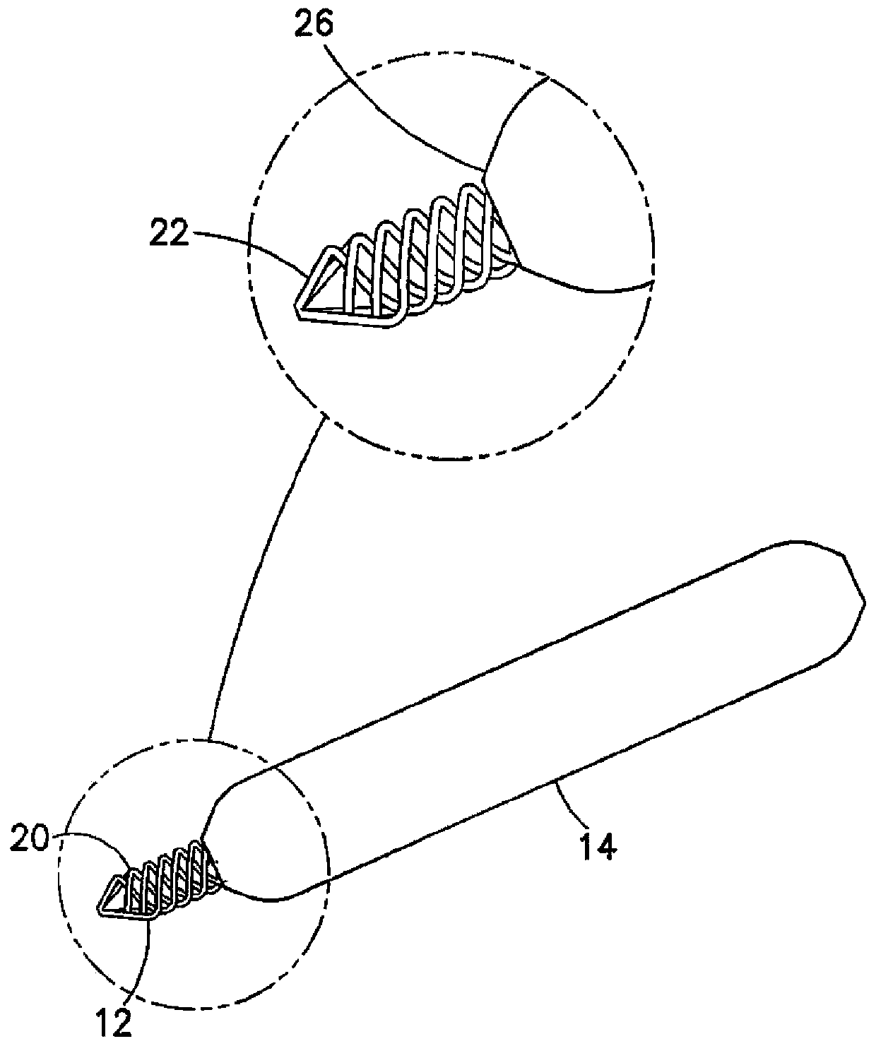 Urological stent