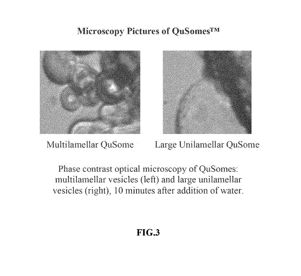 Liposome formulations