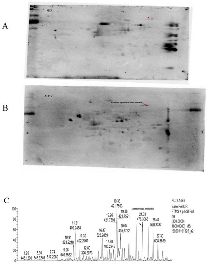 A detection kit for detecting anti-aconitic acid hydratase-igg antibody