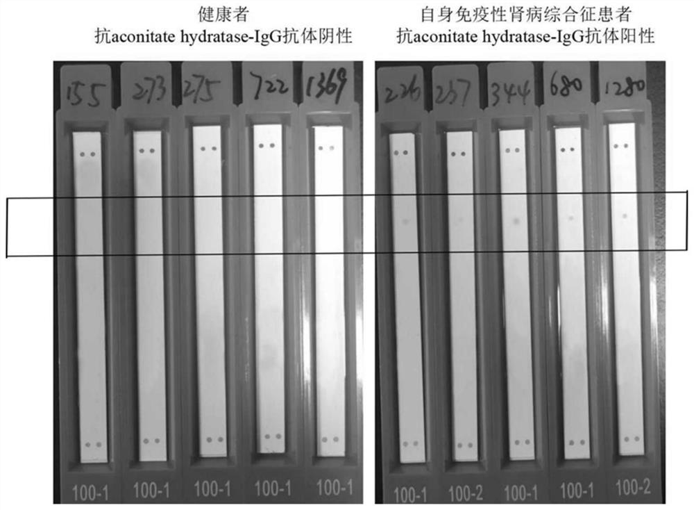 A detection kit for detecting anti-aconitic acid hydratase-igg antibody