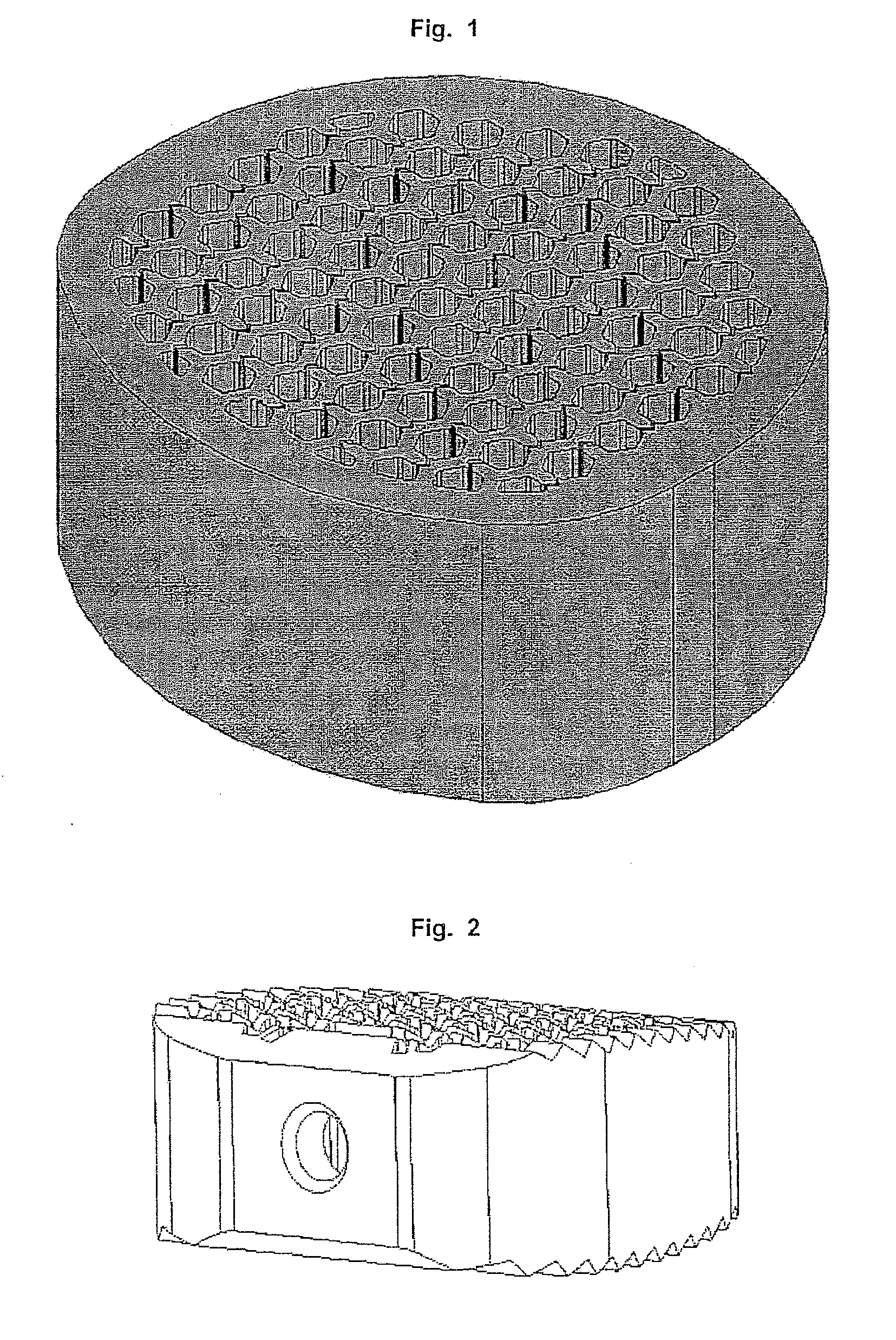 Intervertebral implant