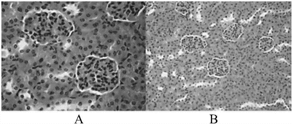 Application of sunflower small molecule peptide in reduction of uric acid, dissolving of uratoma and repairing of renal function