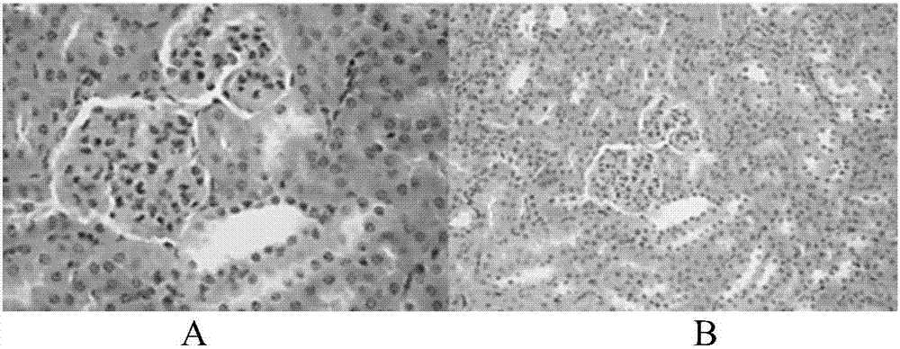 Application of sunflower small molecule peptide in reduction of uric acid, dissolving of uratoma and repairing of renal function