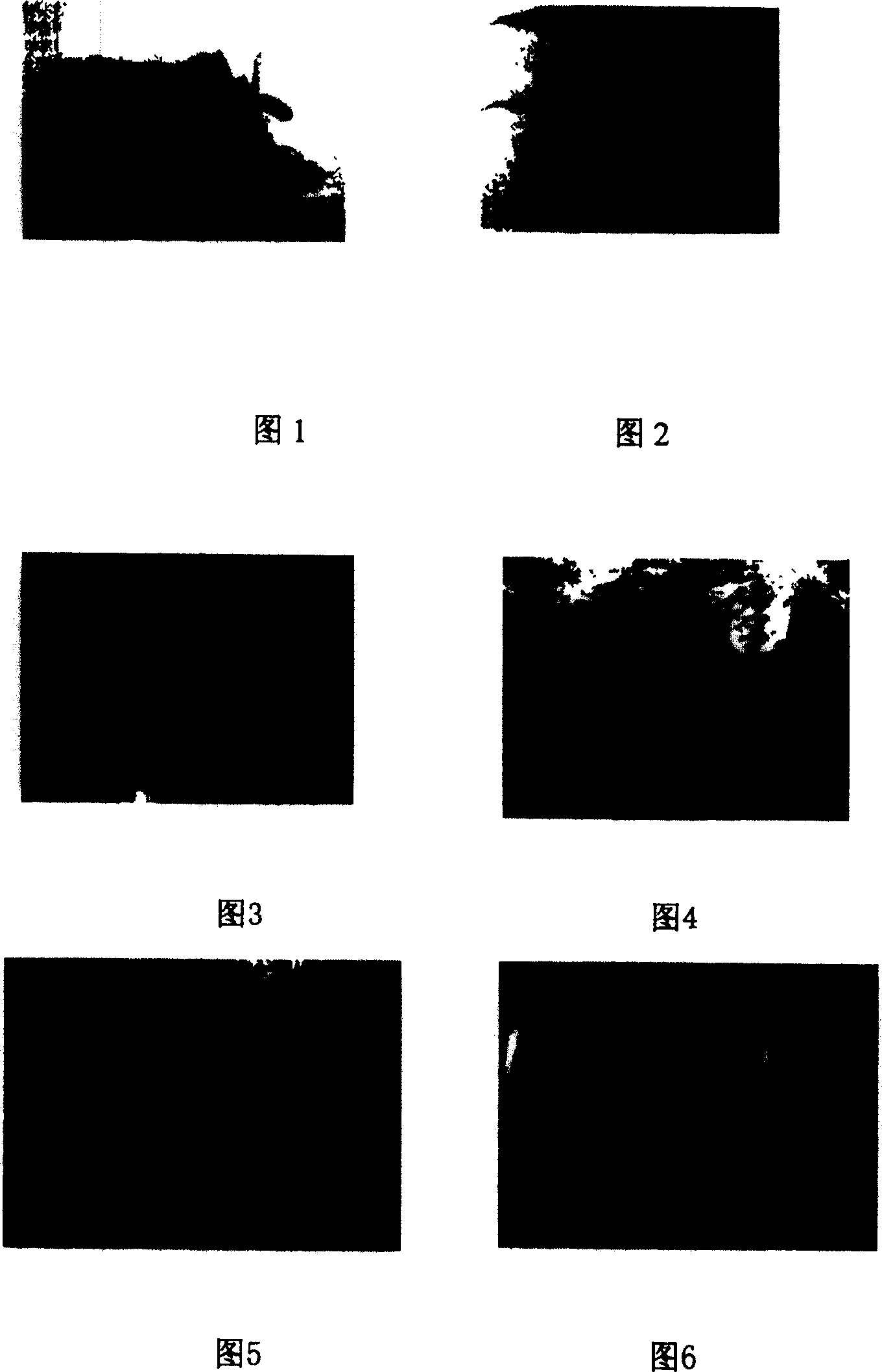 Quick breeding method for inducing spheroidal embryo directly from tissue of anthurium