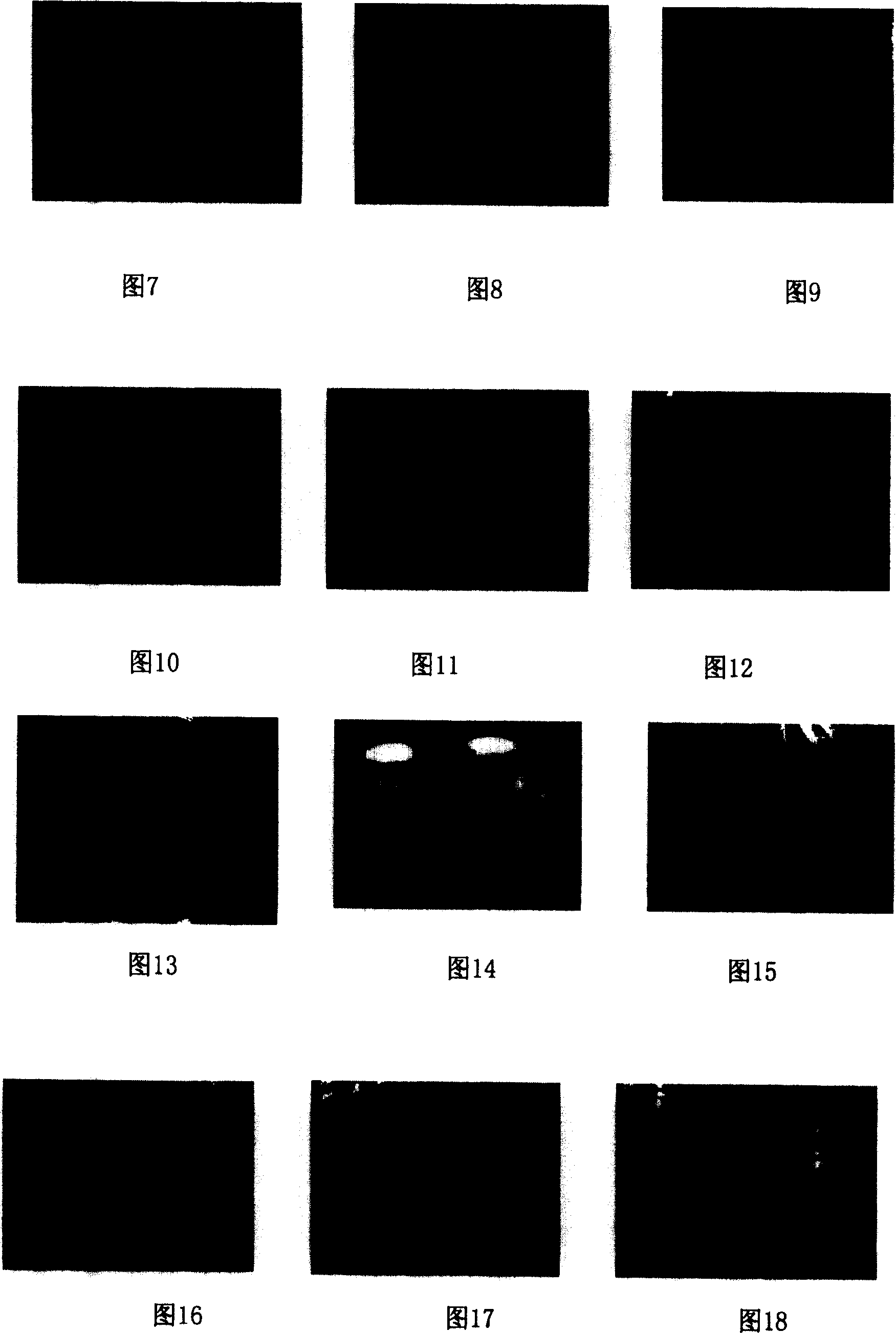 Quick breeding method for inducing spheroidal embryo directly from tissue of anthurium