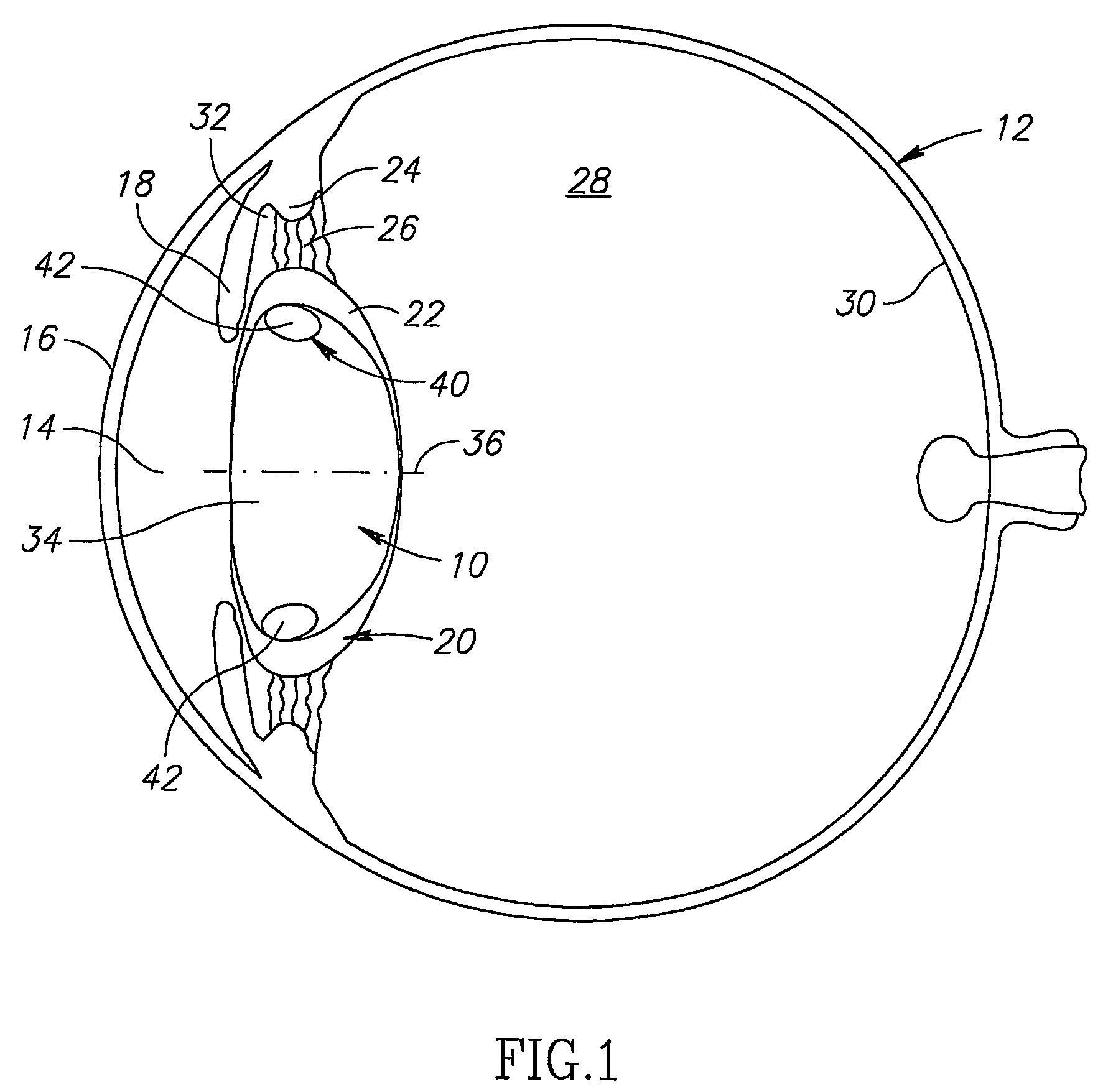 Tensioning intraocular lens assembly