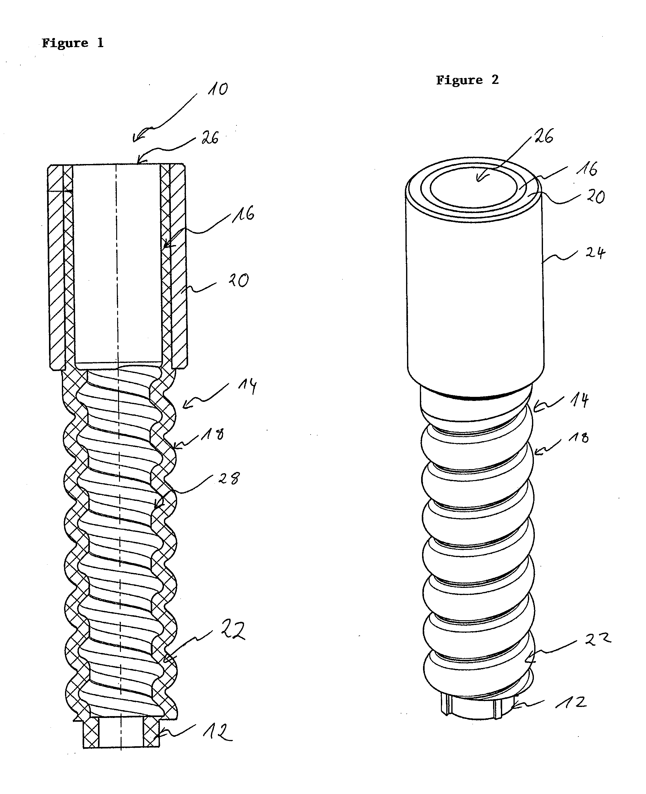 Screw dowel for fastening rails