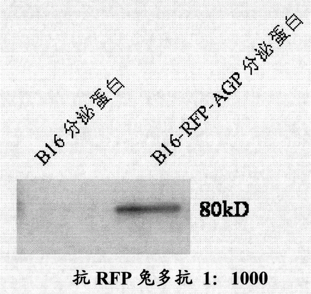 Monoclonal antibody against human alpha1 acid glycoprotein and preparation method thereof