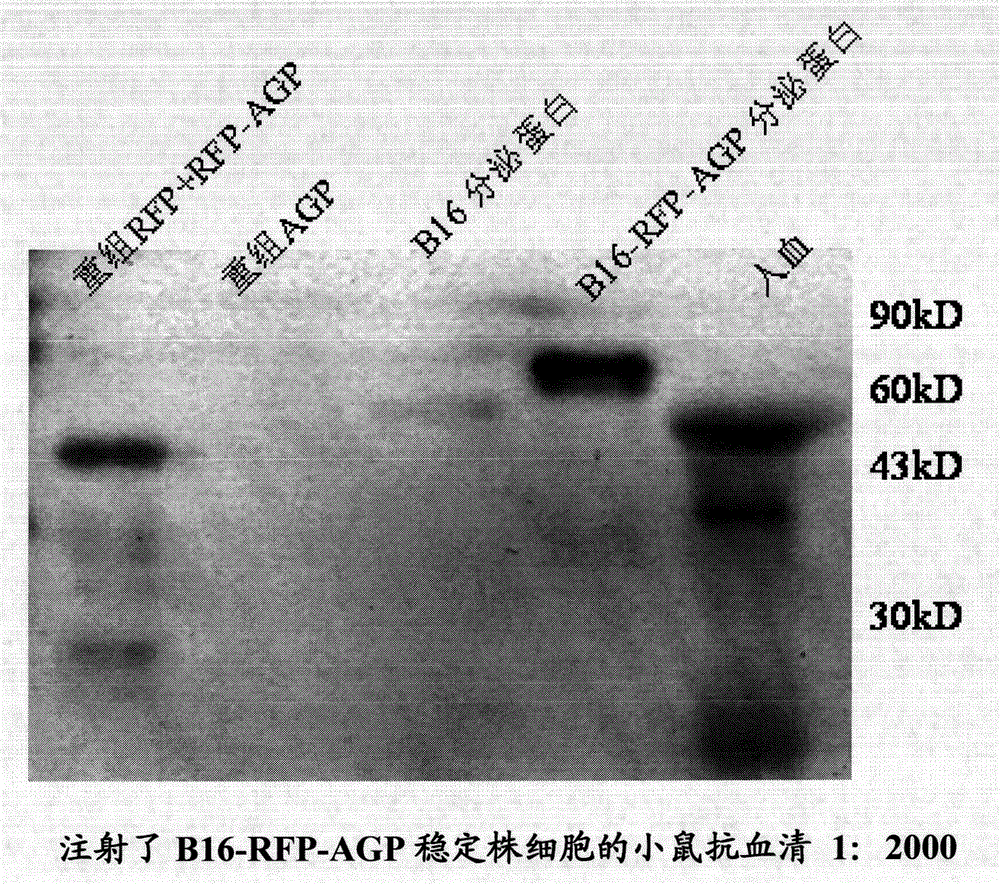 Monoclonal antibody against human alpha1 acid glycoprotein and preparation method thereof