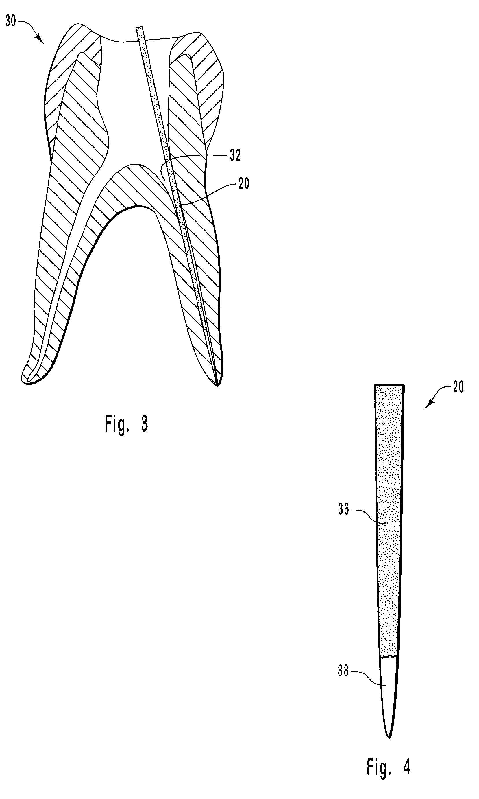 Water and sodium hypochlorite indicating endodontic monitoring devices