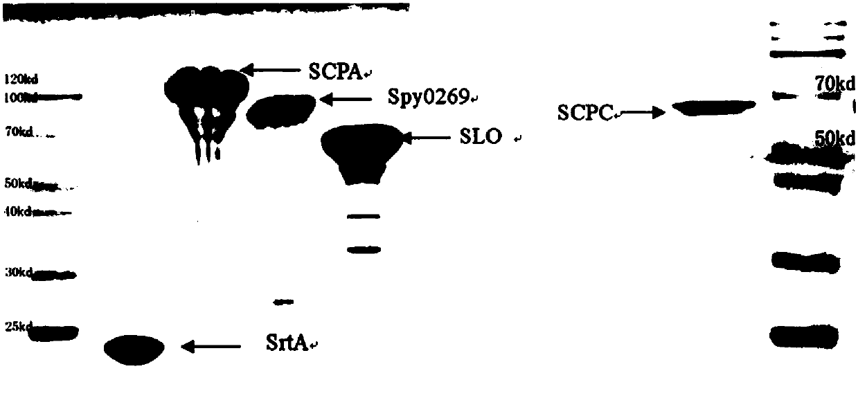 Broad-spectrum multi-subunit vaccine for preventing A type streptococcal infection