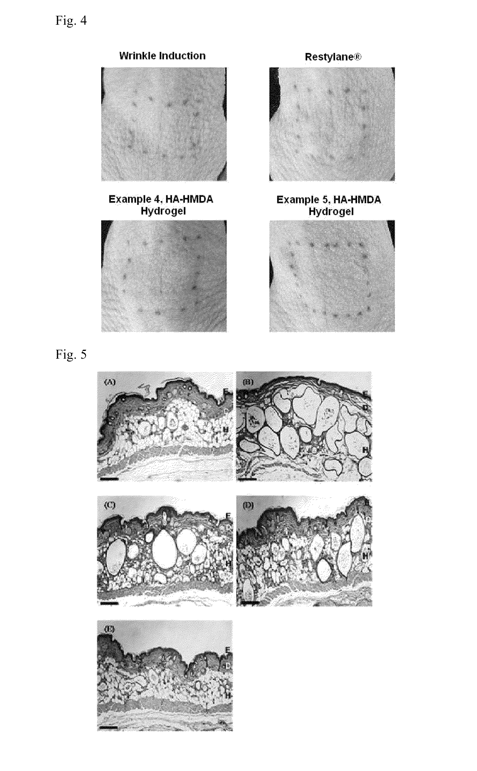 Filler composition for tissue reinforcement