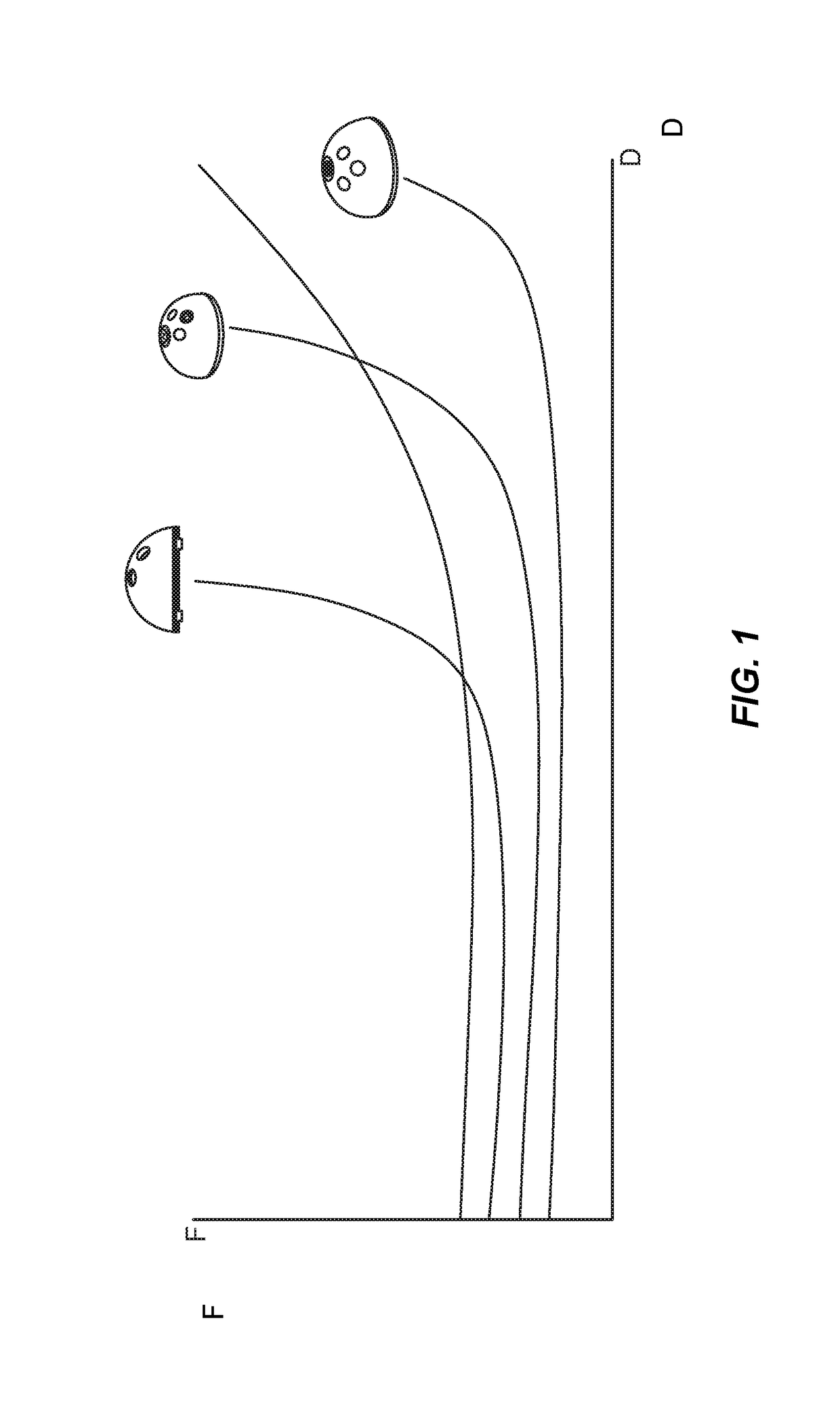 Implant evaluation in prosthesis installation