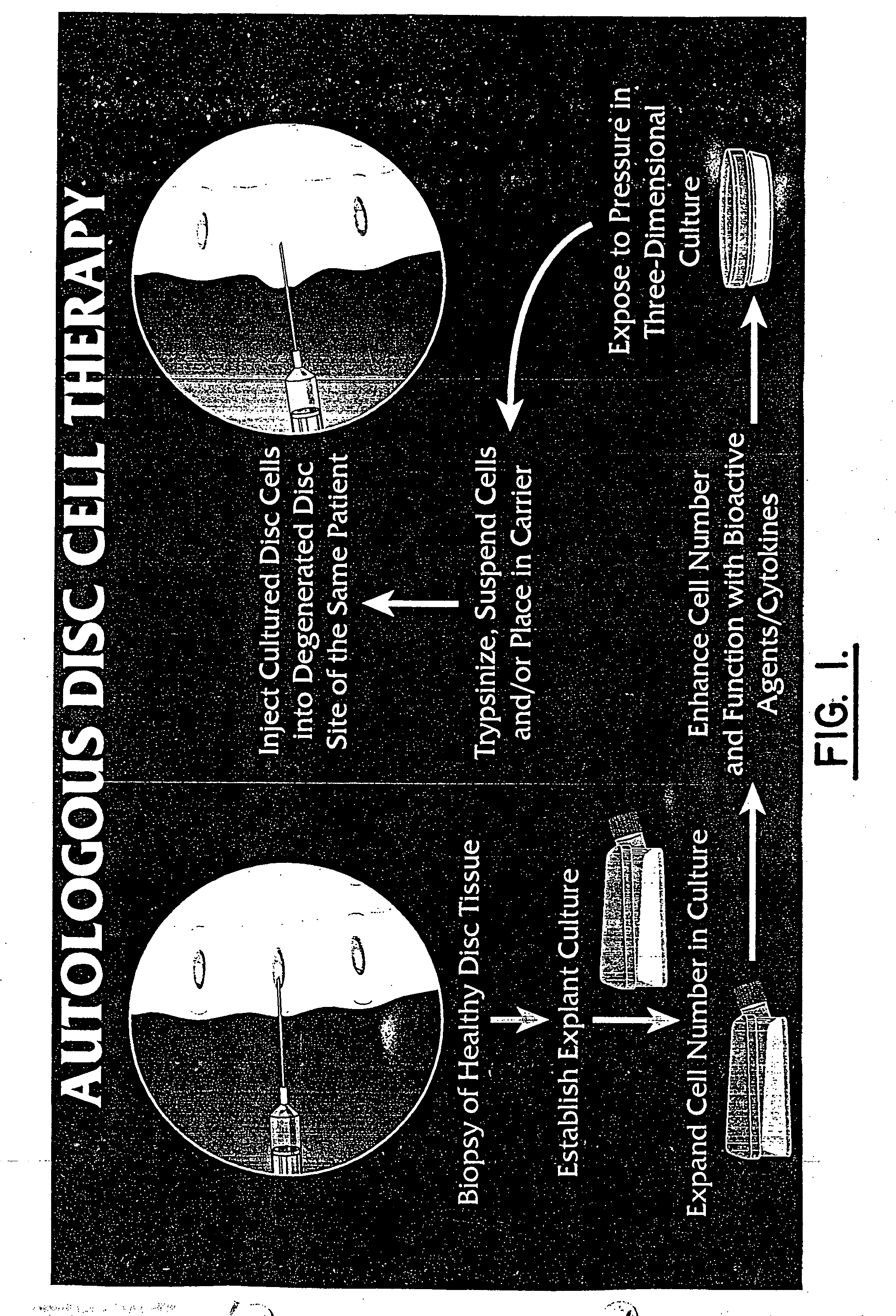 Method for producing human intervertebral disc cells