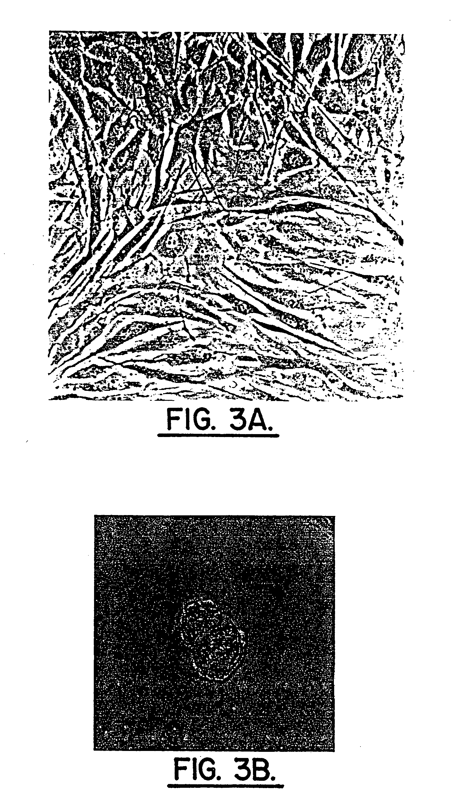 Method for producing human intervertebral disc cells