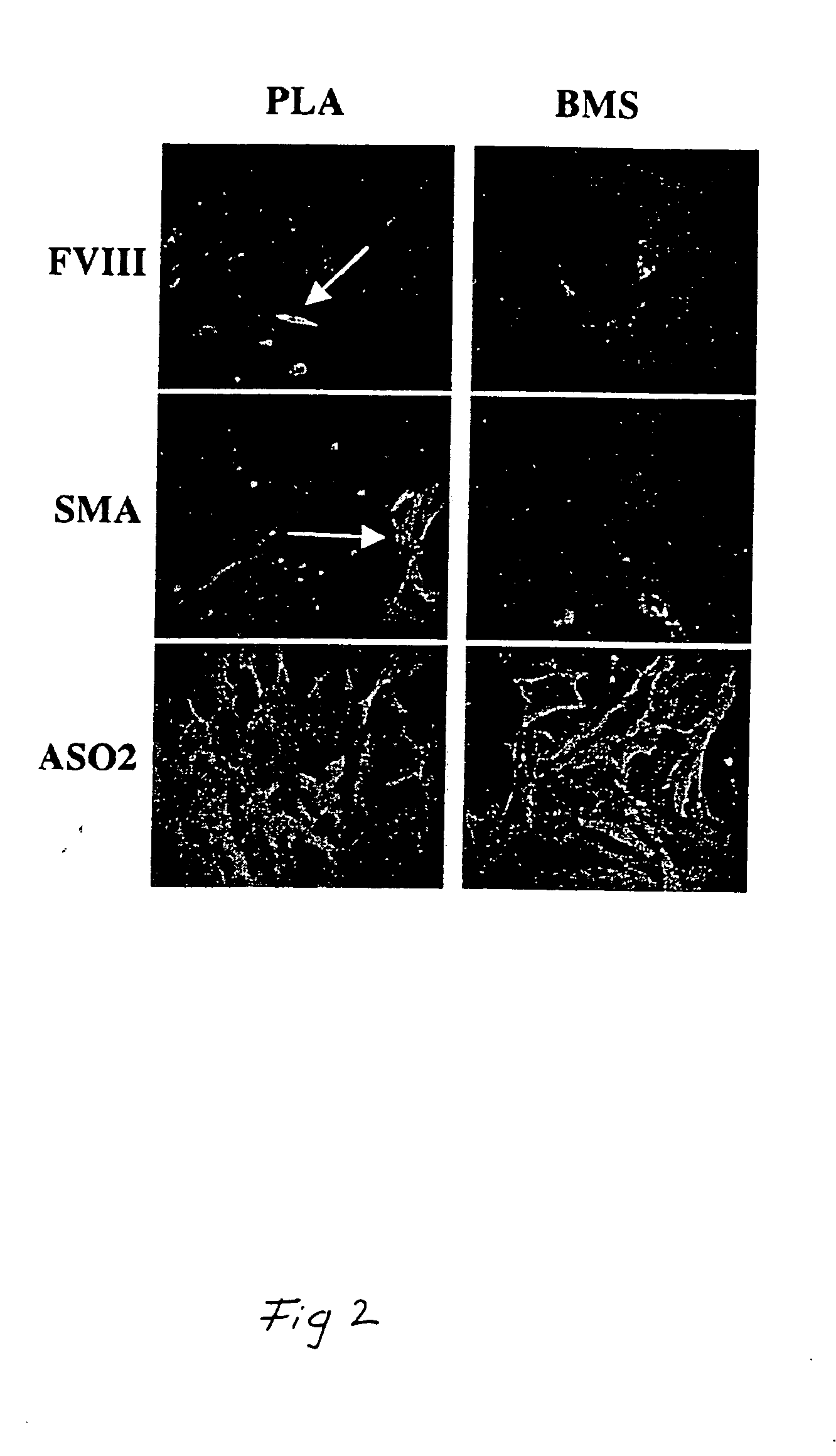 Adipose-derived stem cells and lattices