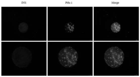 Islet cells differentiated from stem cells, method, compound and application