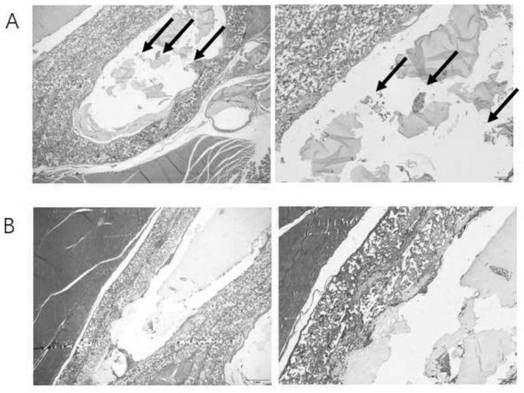 Islet cells differentiated from stem cells, method, compound and application