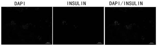 Islet cells differentiated from stem cells, method, compound and application