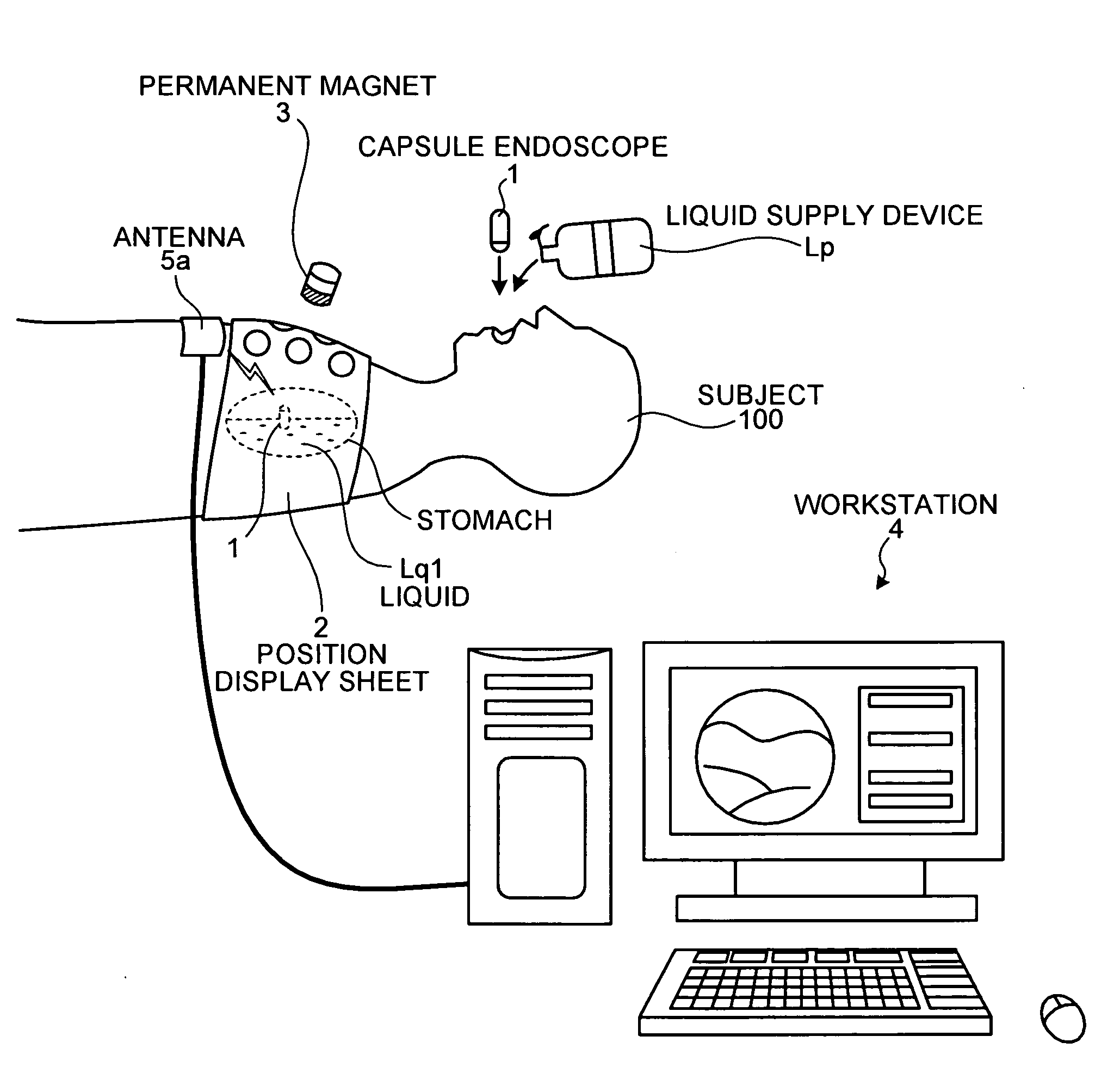 Body-insertable device system and body-insertable device guiding method