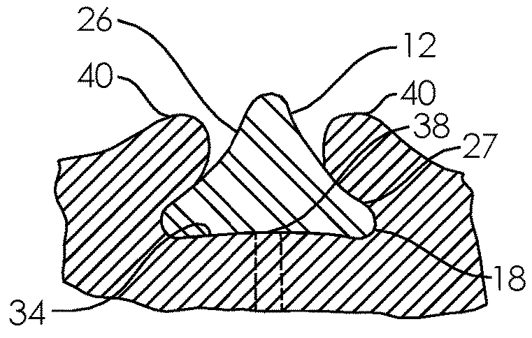 Systems and methods for incontinence control