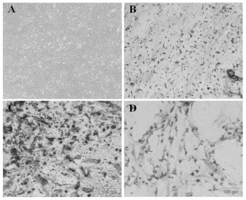 Immunosuppression or anti-inflammatory function enhanced PD-L1 positive mesenchymal stem cells (MSCs), induction kit and application