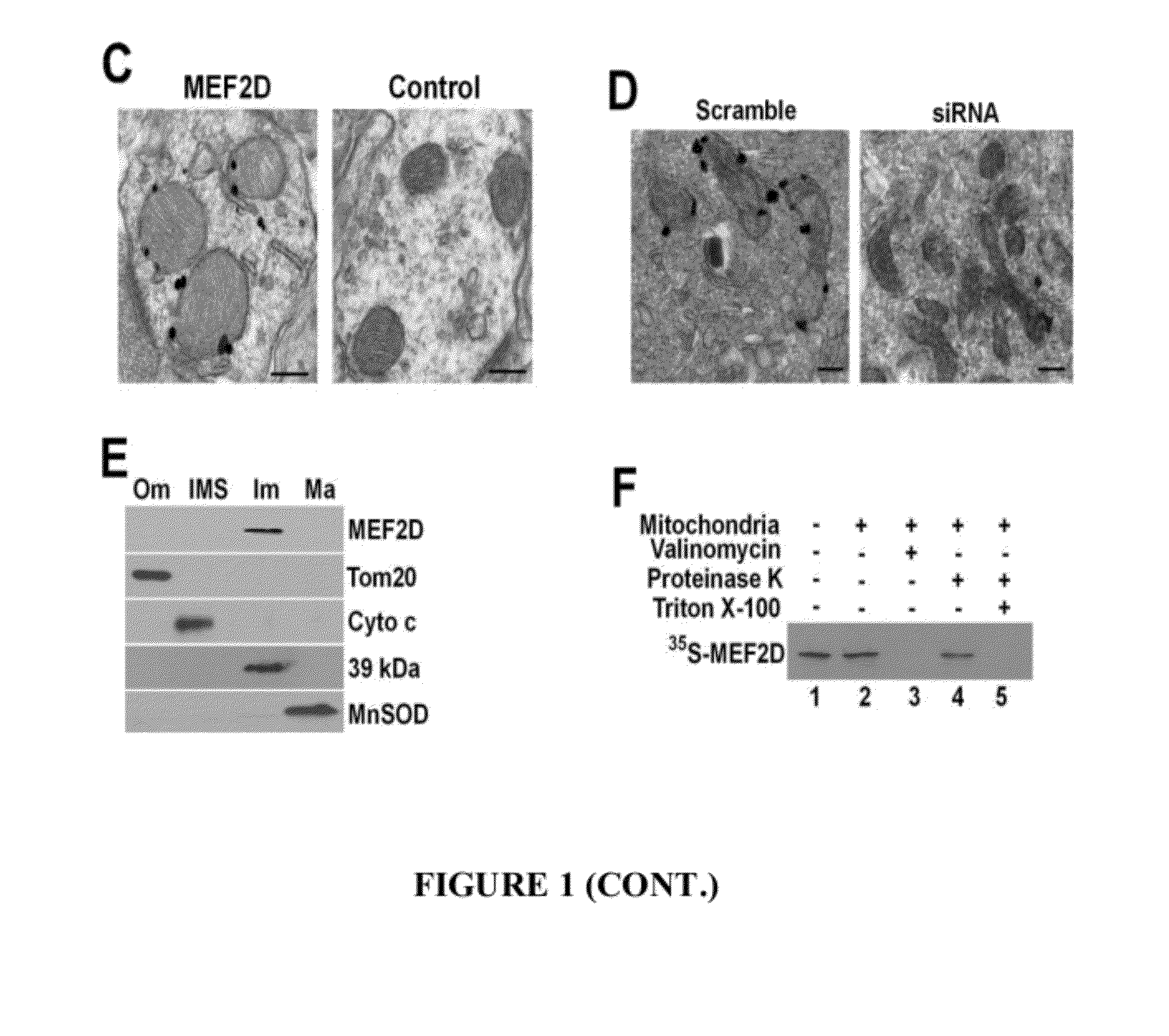 Compositions and modulation of myocyte enhancer factor 2 (MEF2)