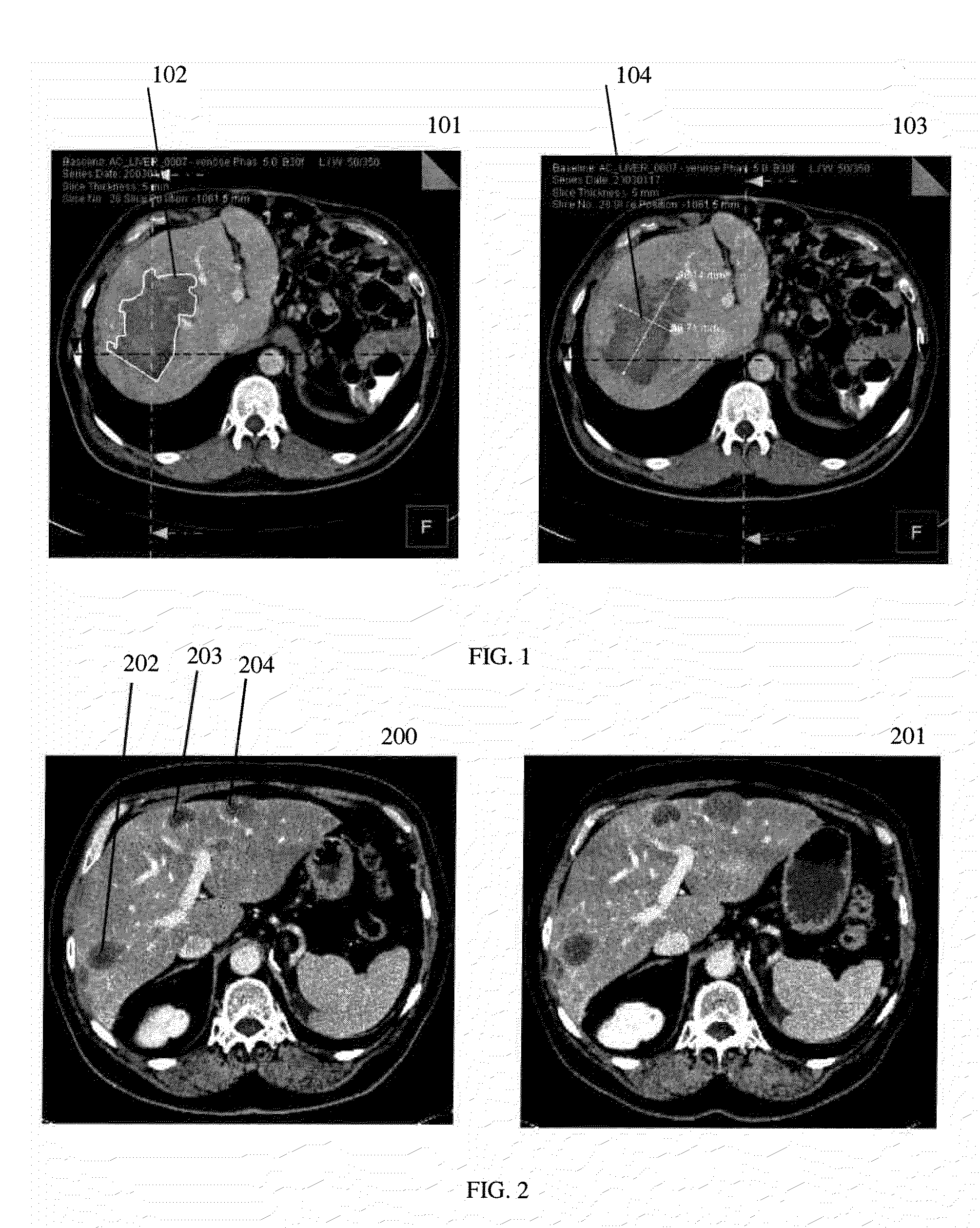 Combined Segmentation And Registration Framework For Parametric Shapes