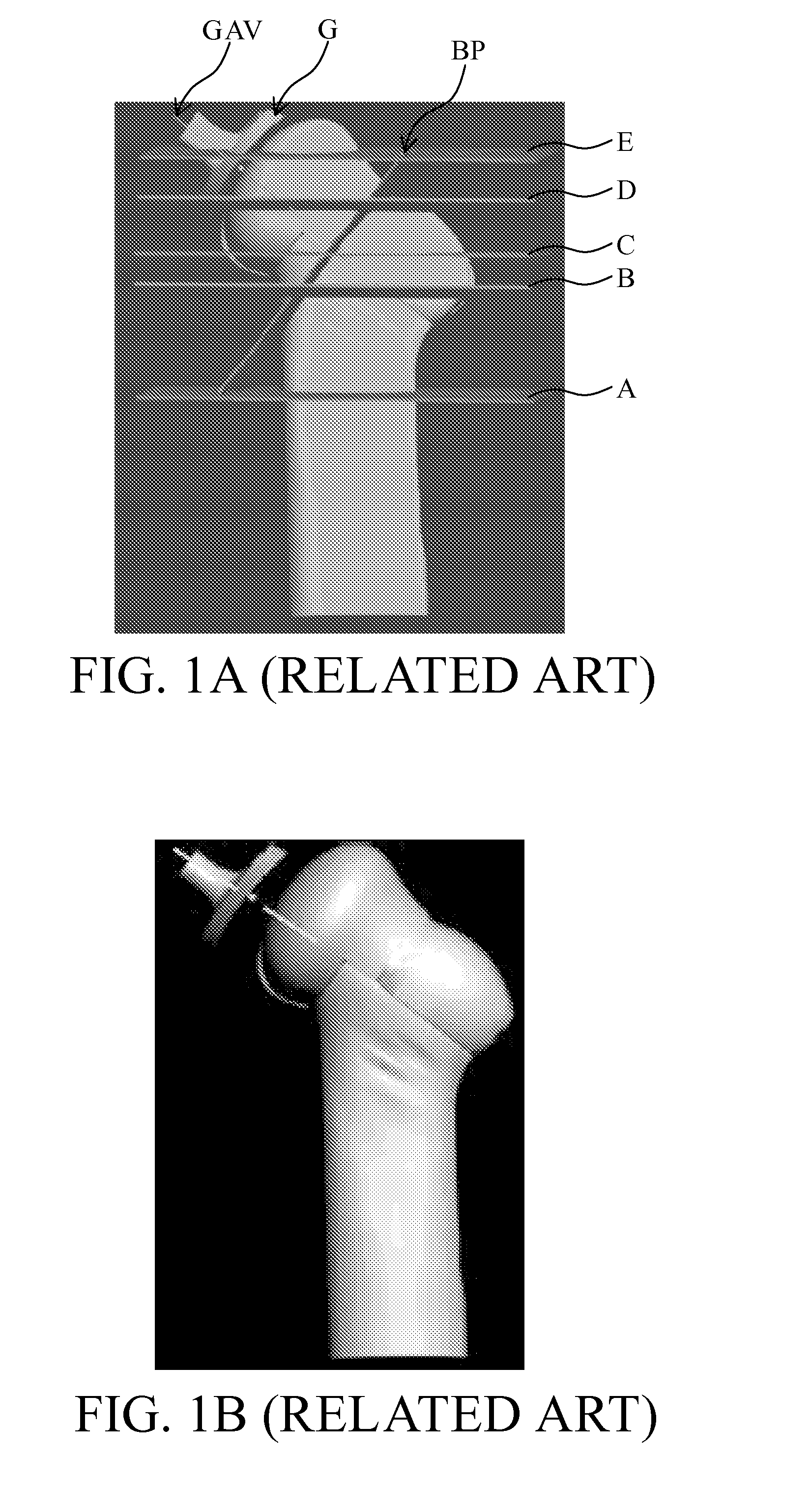 Image analysis methods for gleno-humeral joint morphology