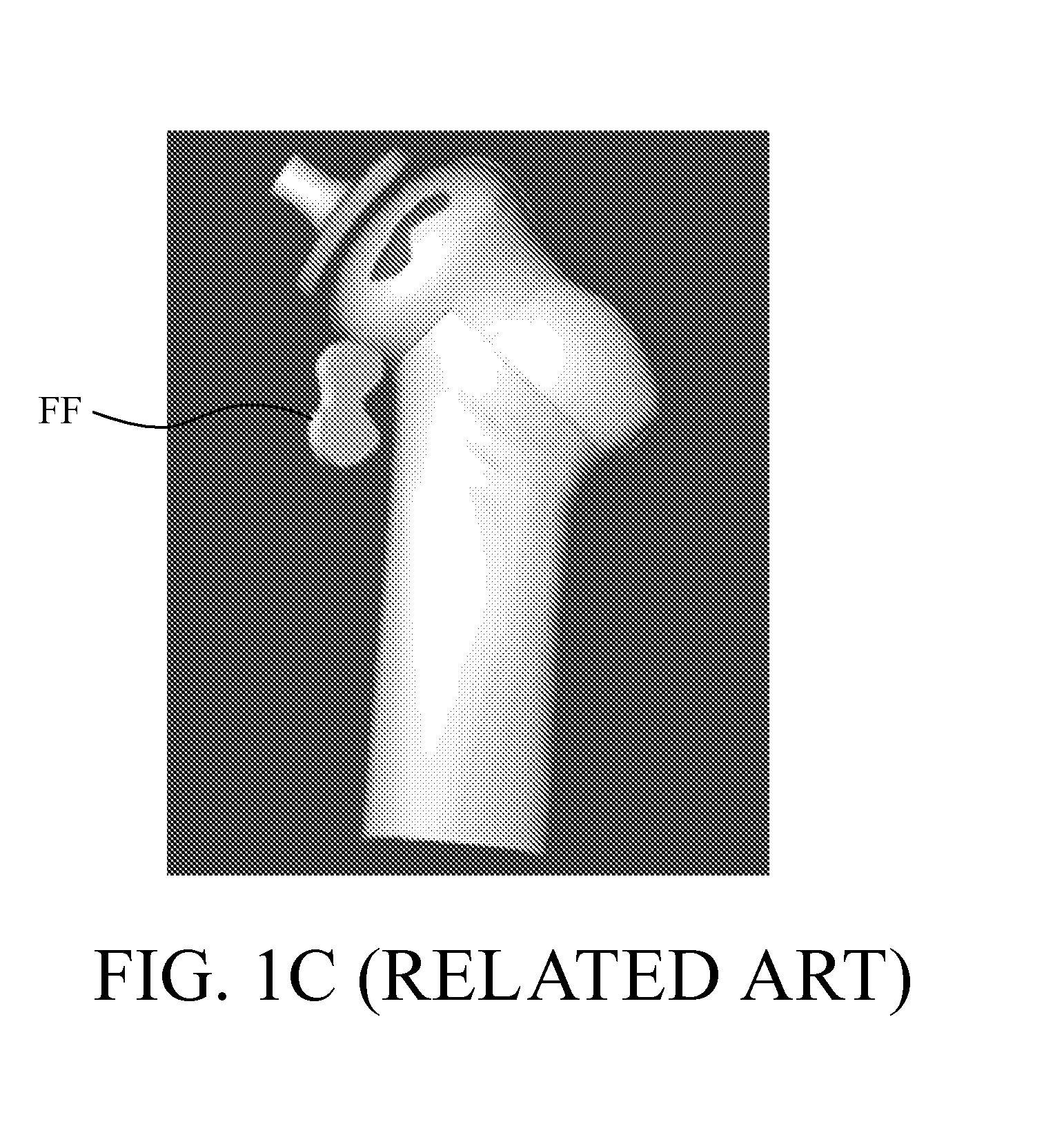 Image analysis methods for gleno-humeral joint morphology