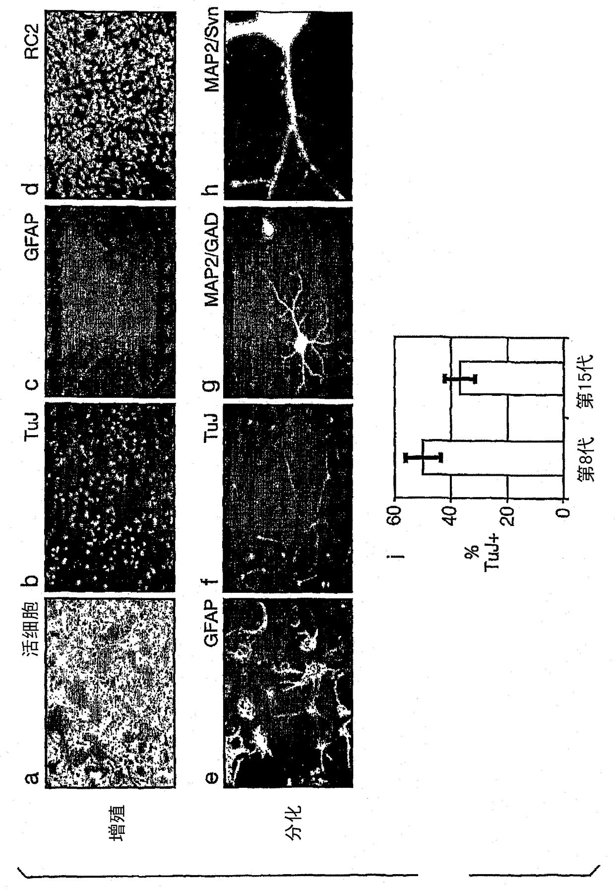 neural stem cells