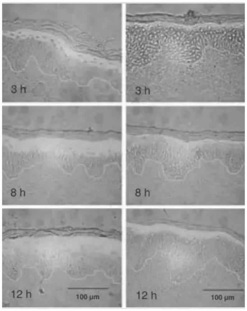 Preparation method of antioxidant essence acting on skin cells