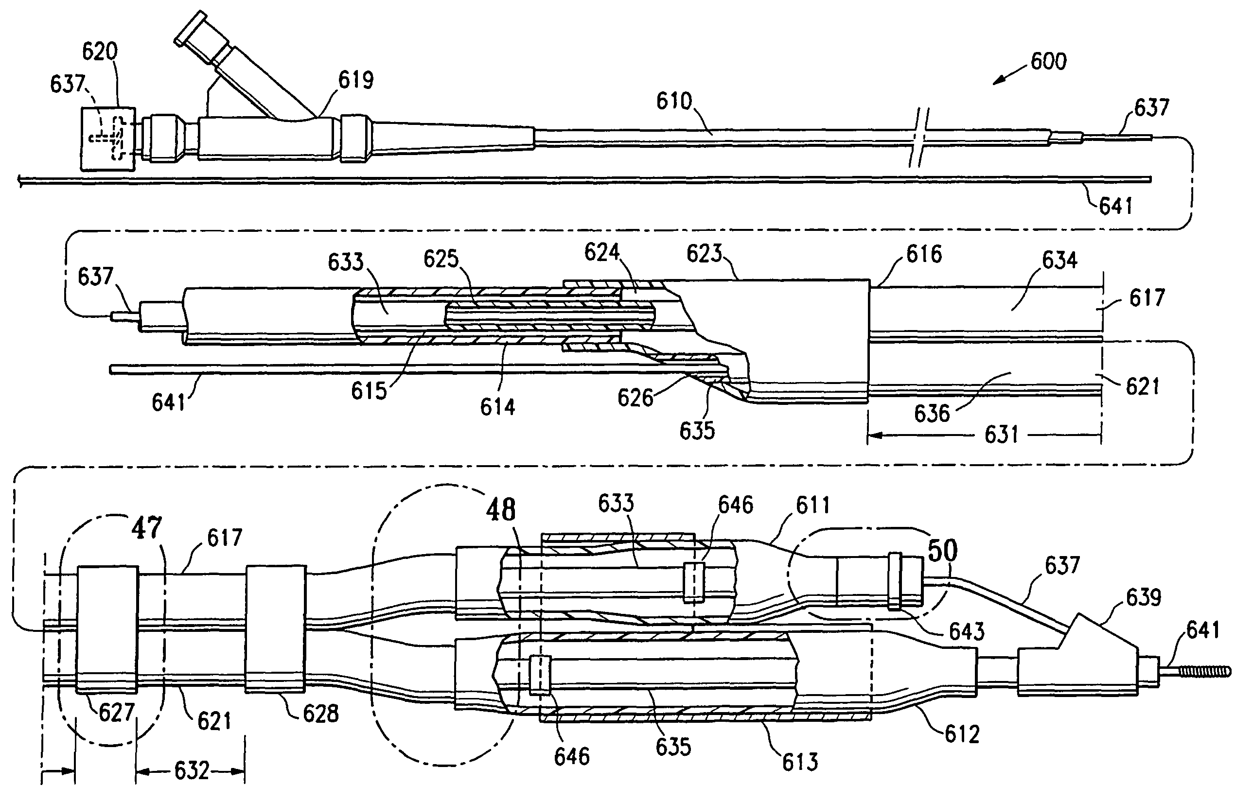 Catheter assembly and method for treating bifurcations