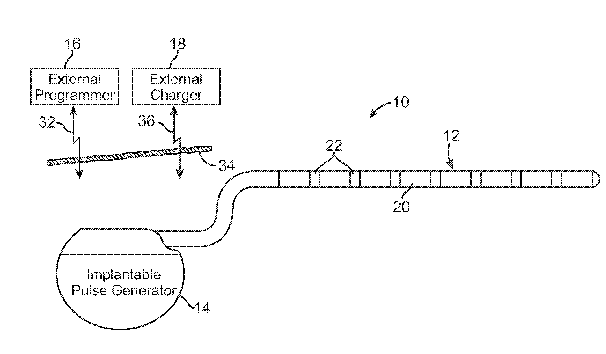 External charger with adjustable alignment indicator