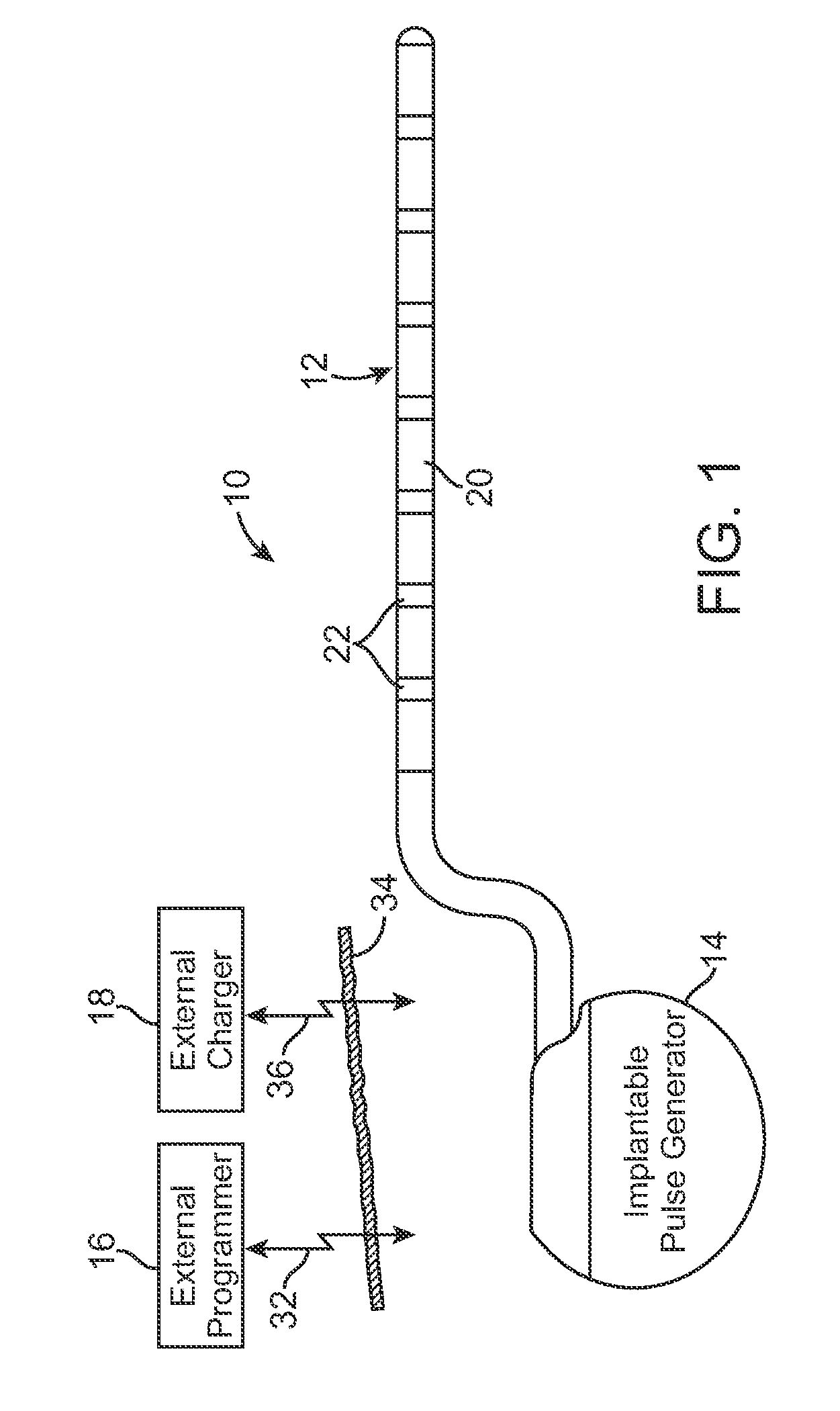 External charger with adjustable alignment indicator