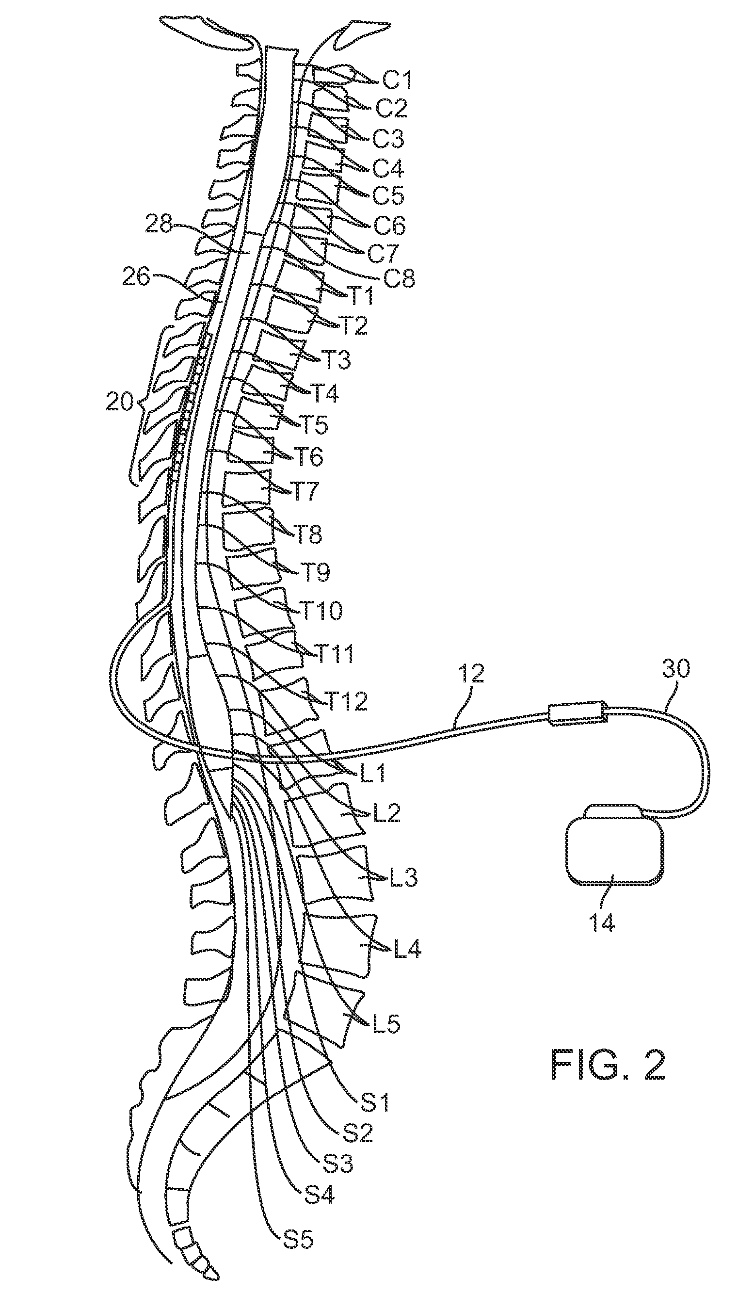 External charger with adjustable alignment indicator