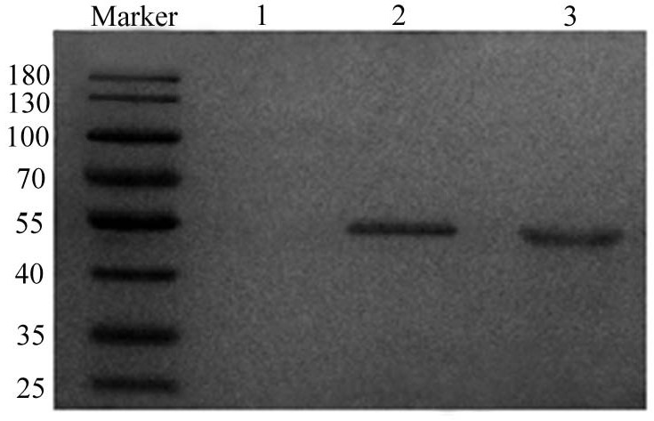 Preparation method and application of immune gel for regulating and controlling tumor microenvironment