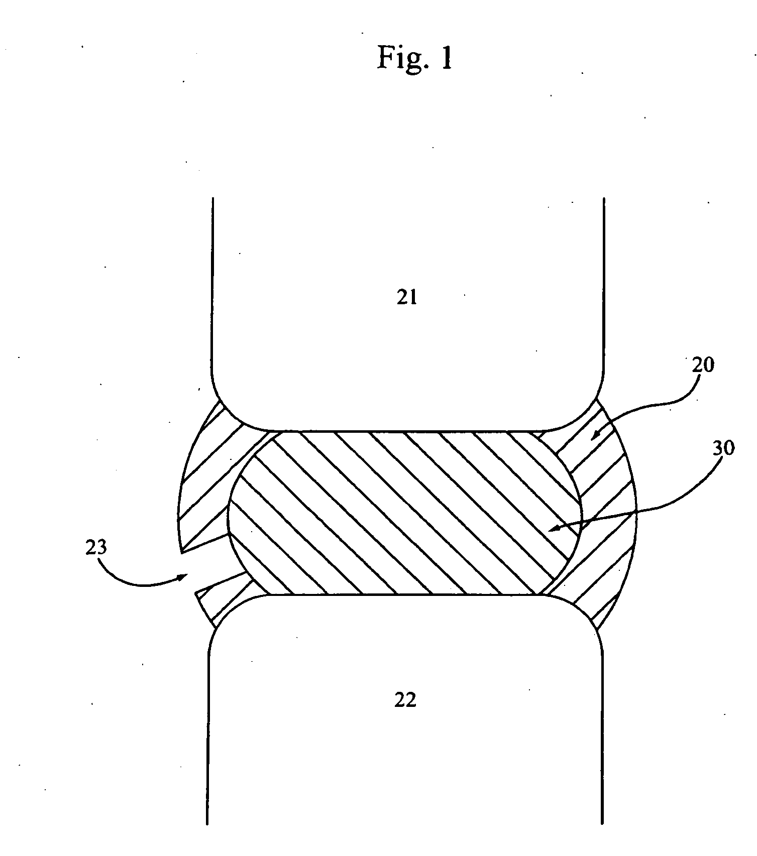 Methods for explantation of intervertebral disc implants