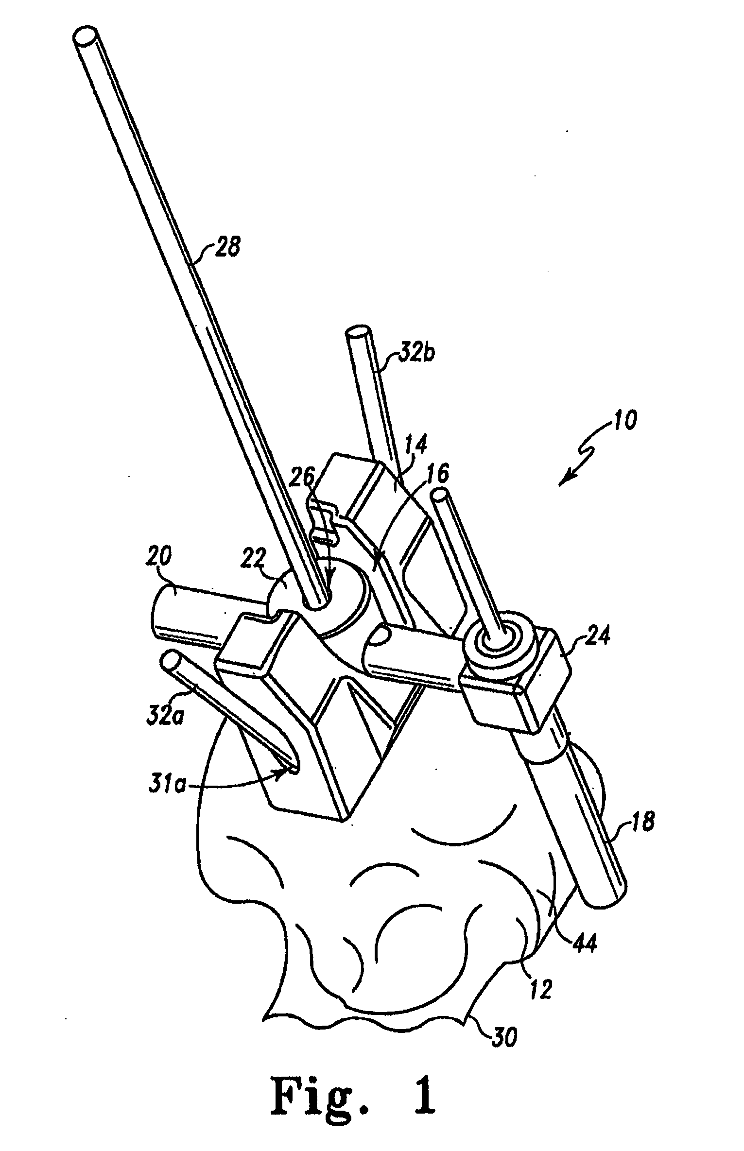 Humeral rotating burr guide