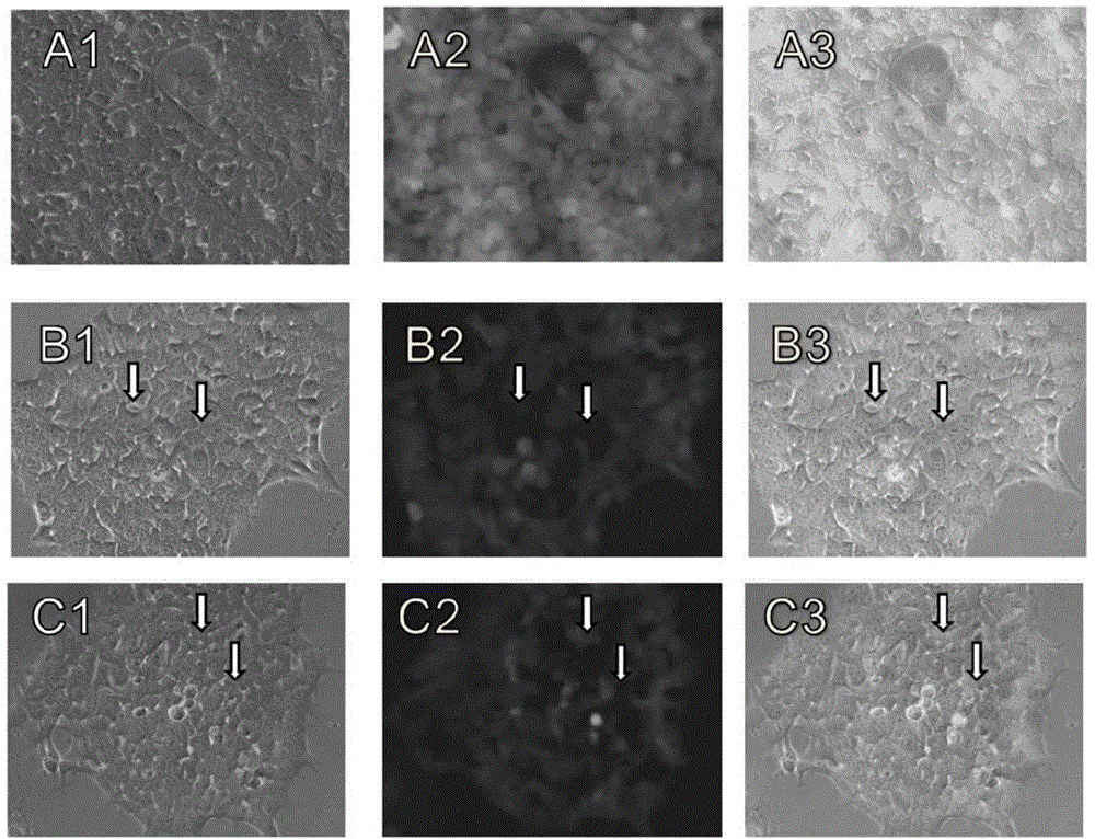 Nucleic acid molecule for encoding Cas9 (CRISPR (clustered regularly interspaced short palindromic repeat)-associated endonuclease 9) protein securely and expression vector of nucleic acid molecule