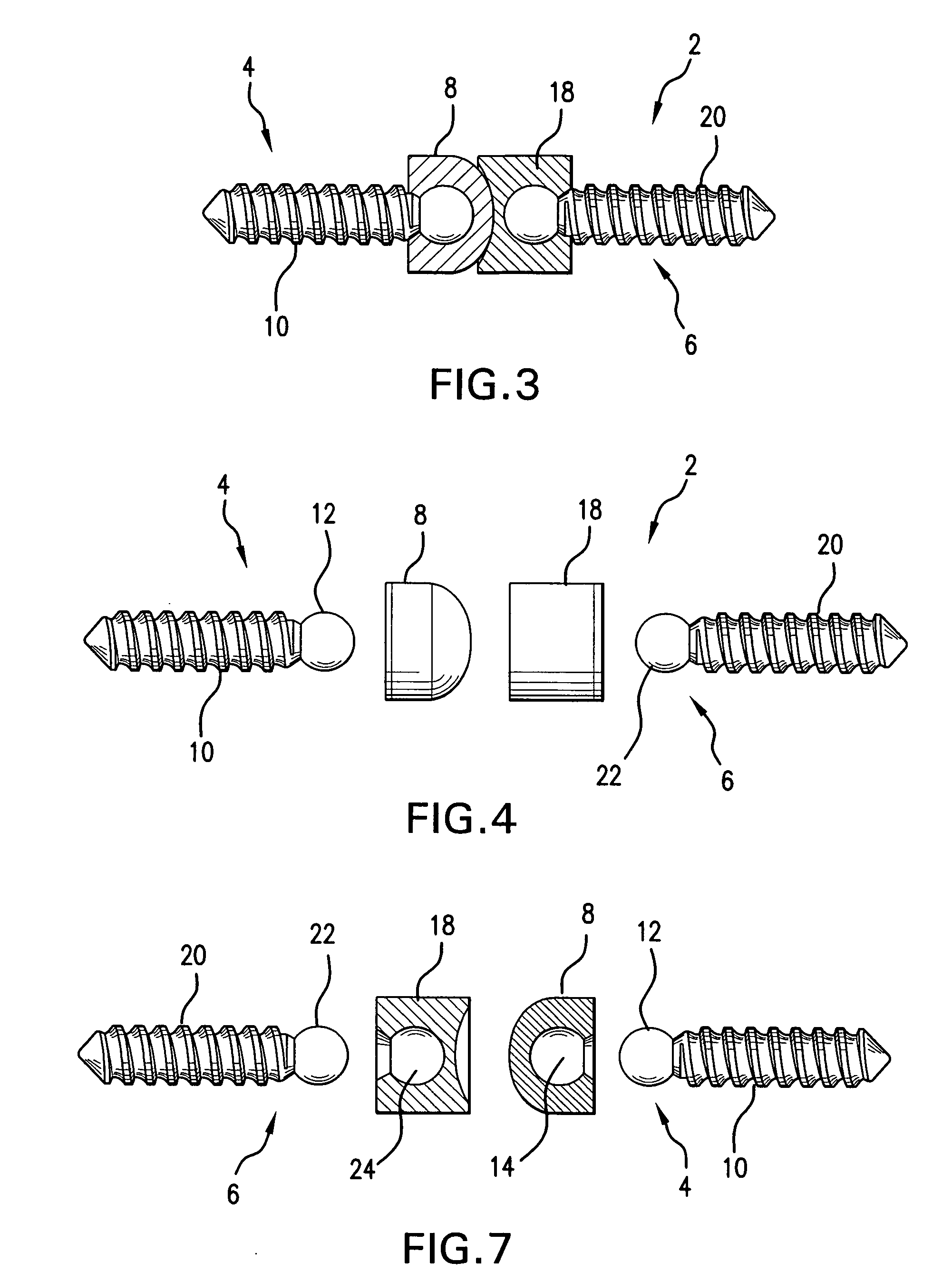 Modular joint replacement implant with hydrogel surface