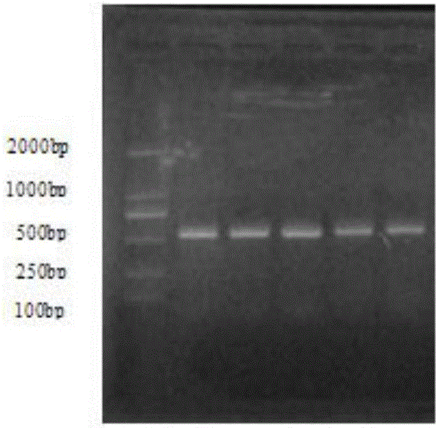 Kit for rapid identification of nocardia and using method of kit