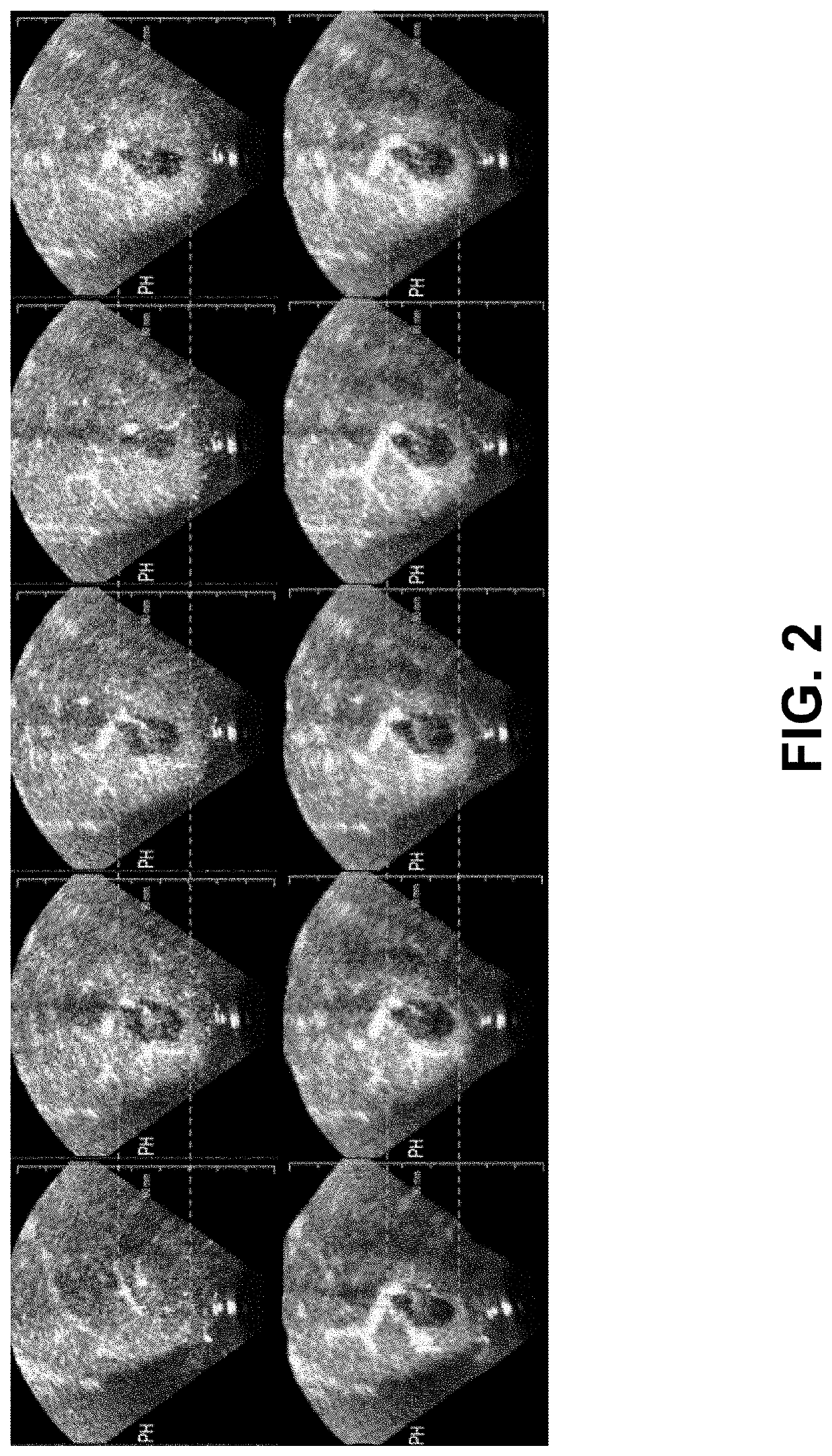 Method for Motion Correction of 3D Contrast Enhanced Ultrasound Without the Availability of Bmode Data