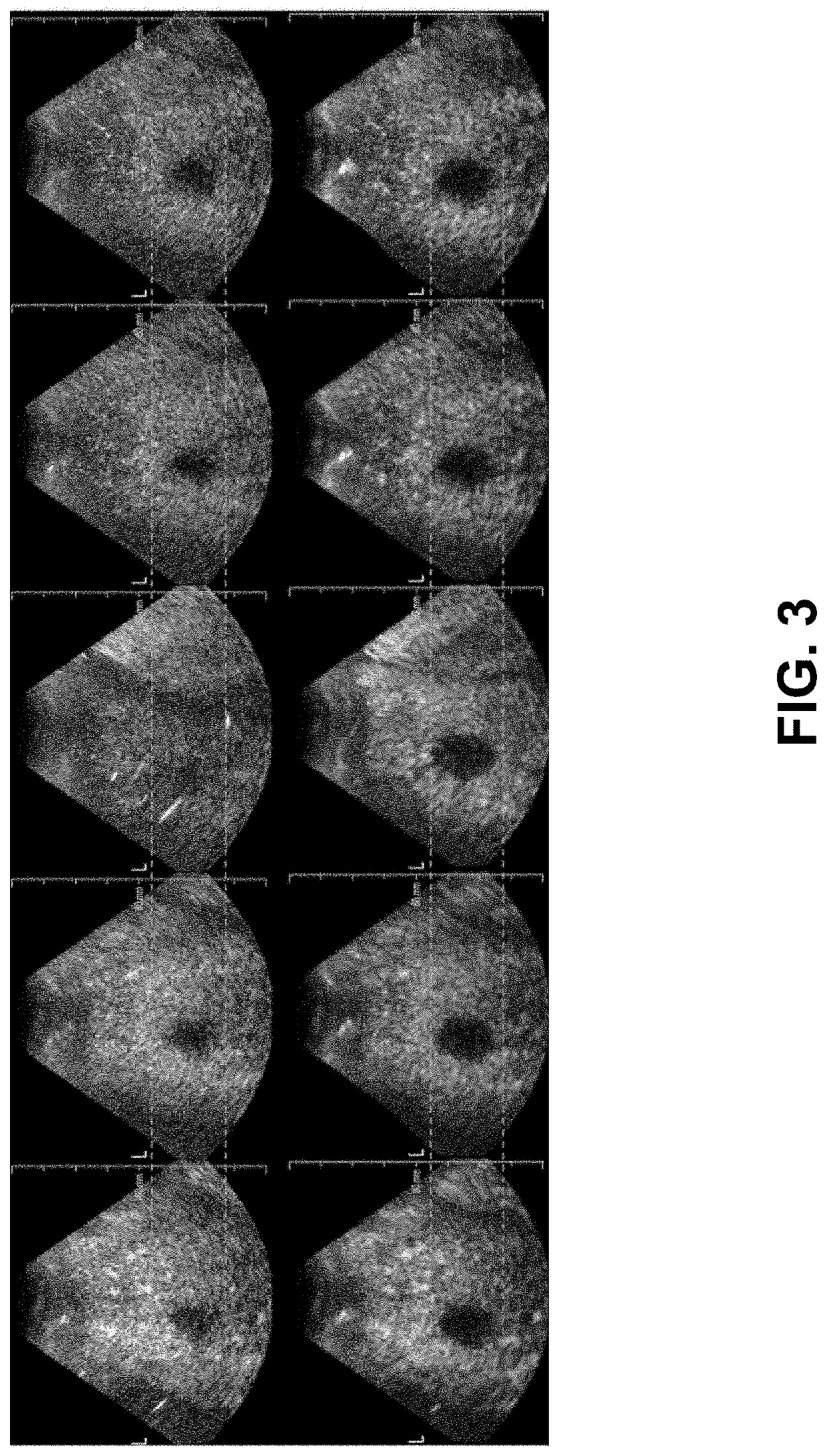 Method for Motion Correction of 3D Contrast Enhanced Ultrasound Without the Availability of Bmode Data