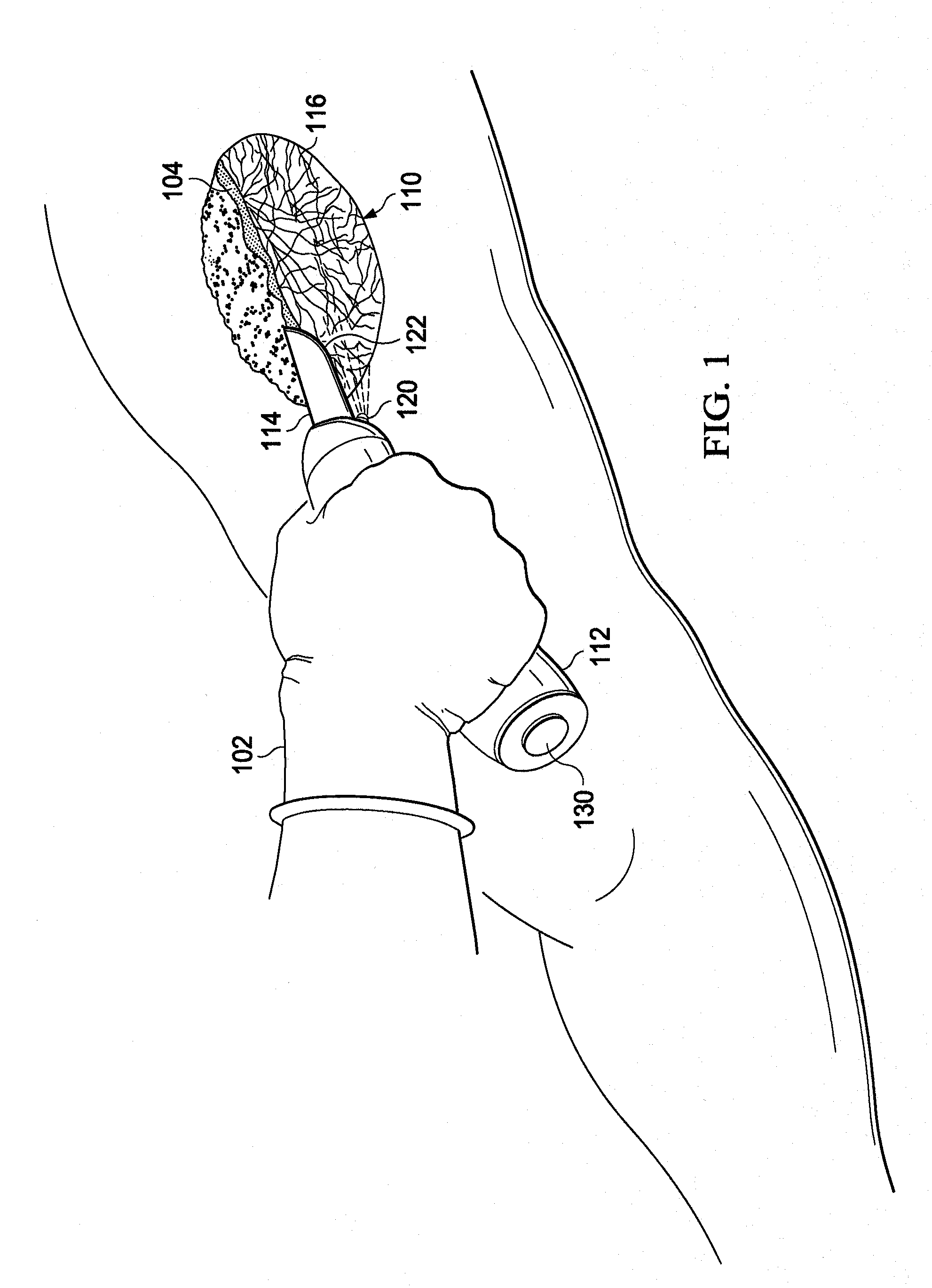 Debridement hand tool