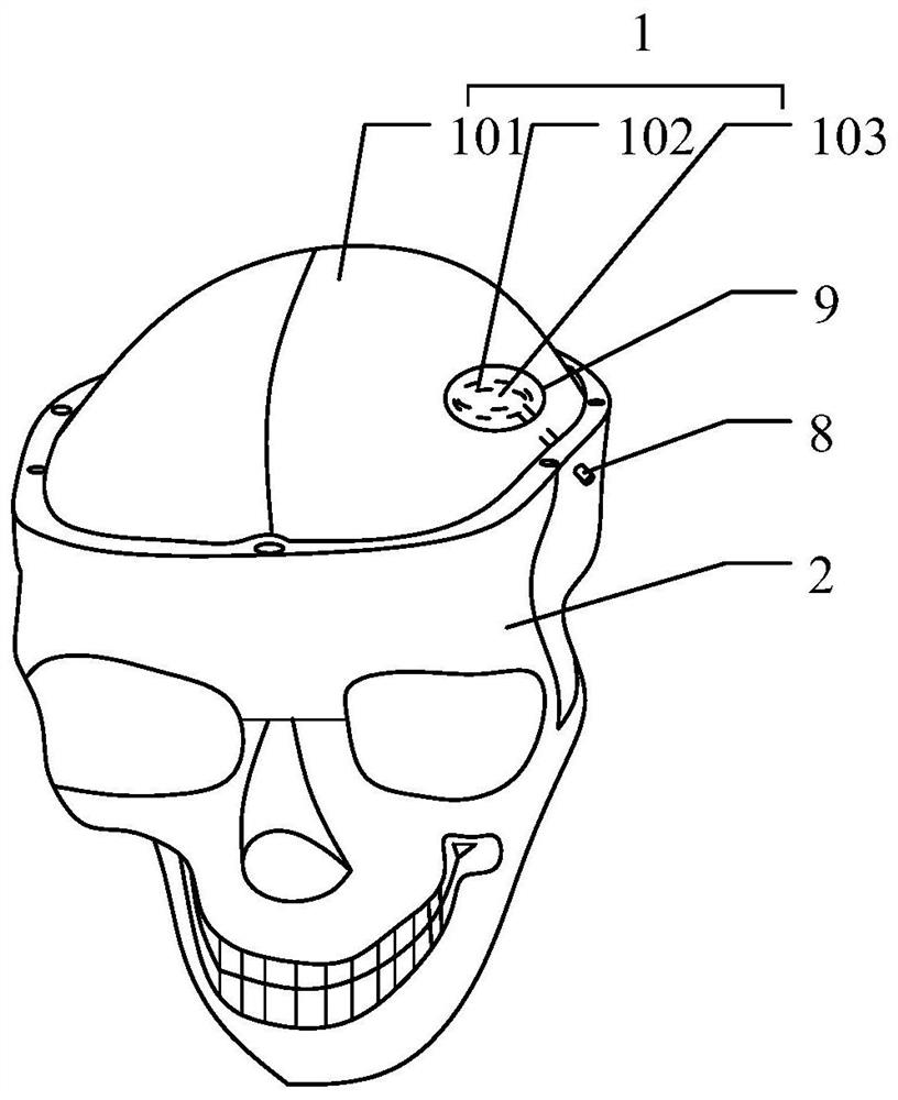 Simulation training model for eliminating intracerebral hematoma and preparation and use methods thereof