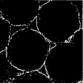 Tooth desensitizer as well as preparation method and application thereof