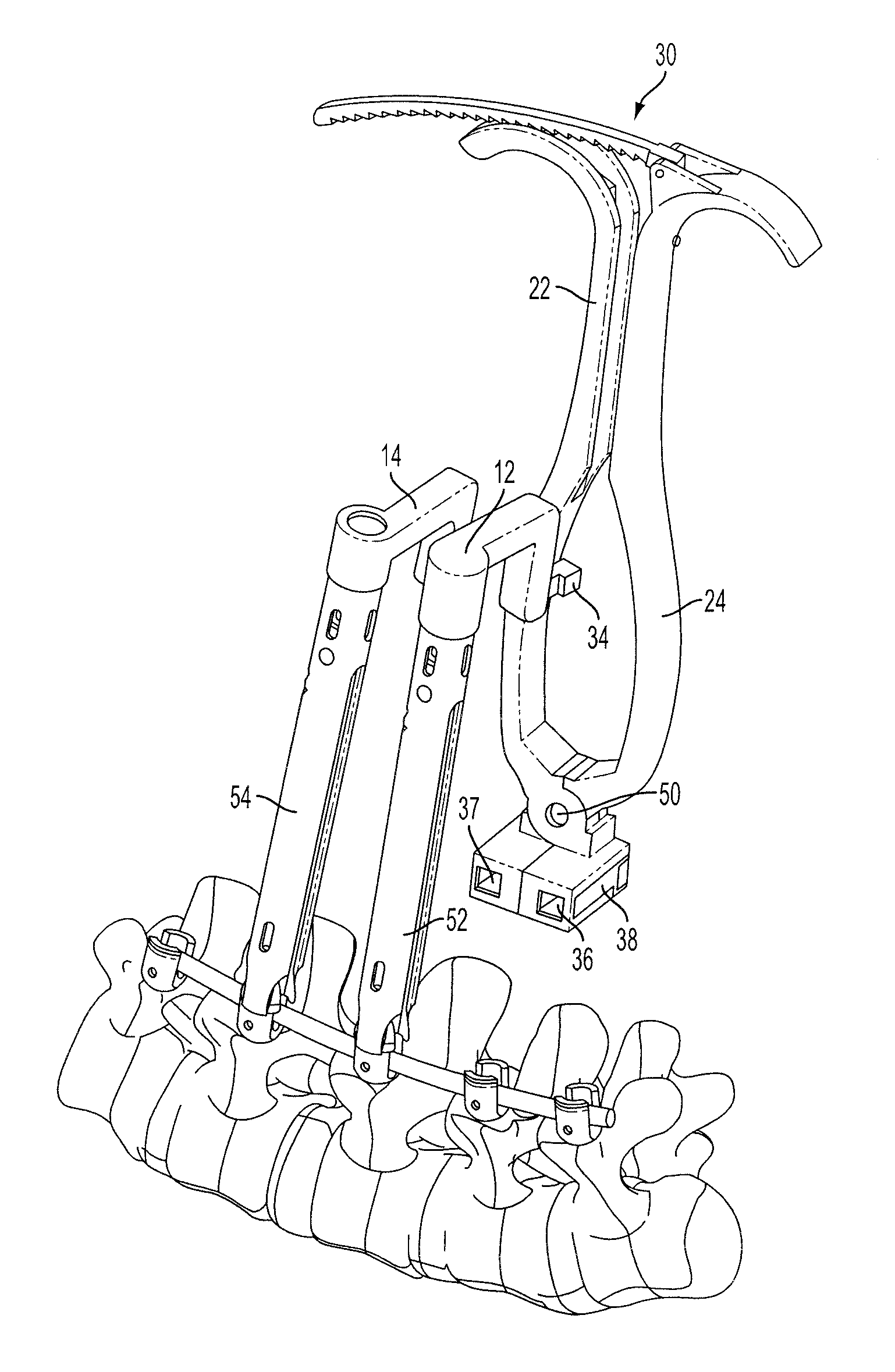 System and Method for Manipulating a Spinal Construct