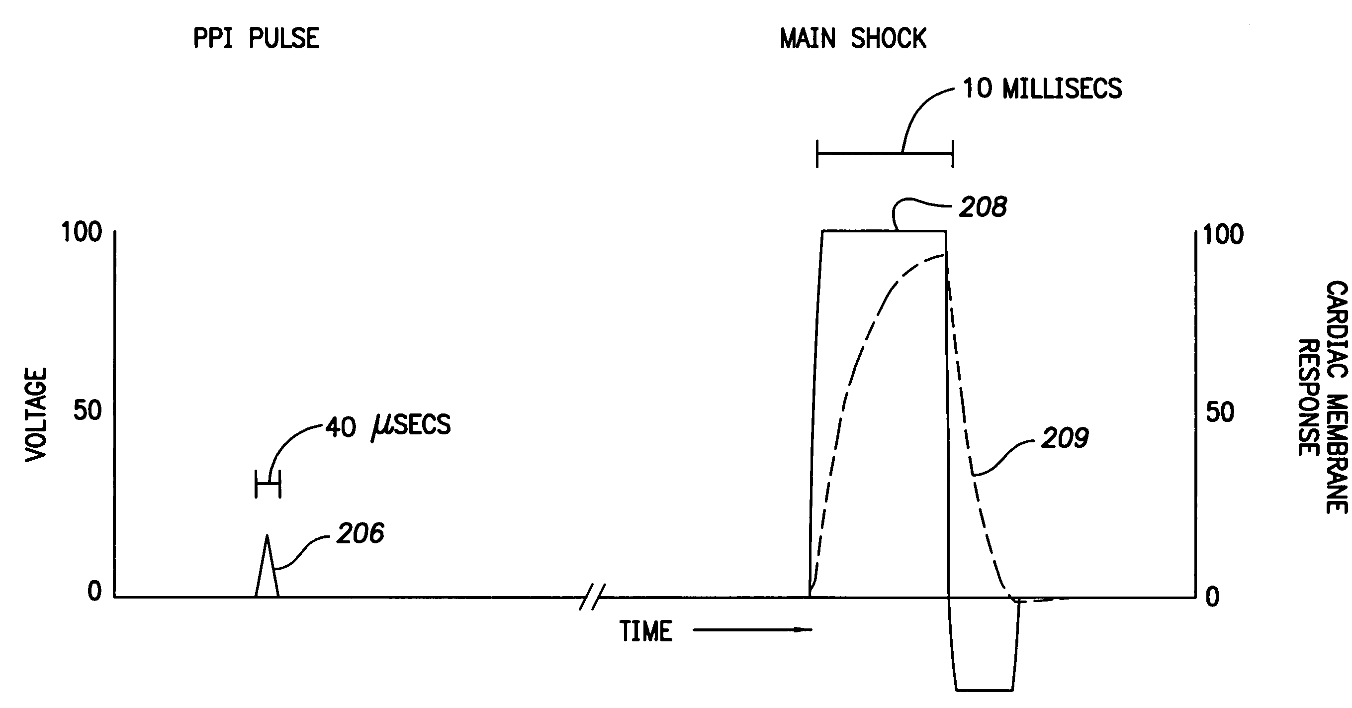 System and method for reducing pain associated with cardioversion shocks generated by implantable cardiac stimulation devices